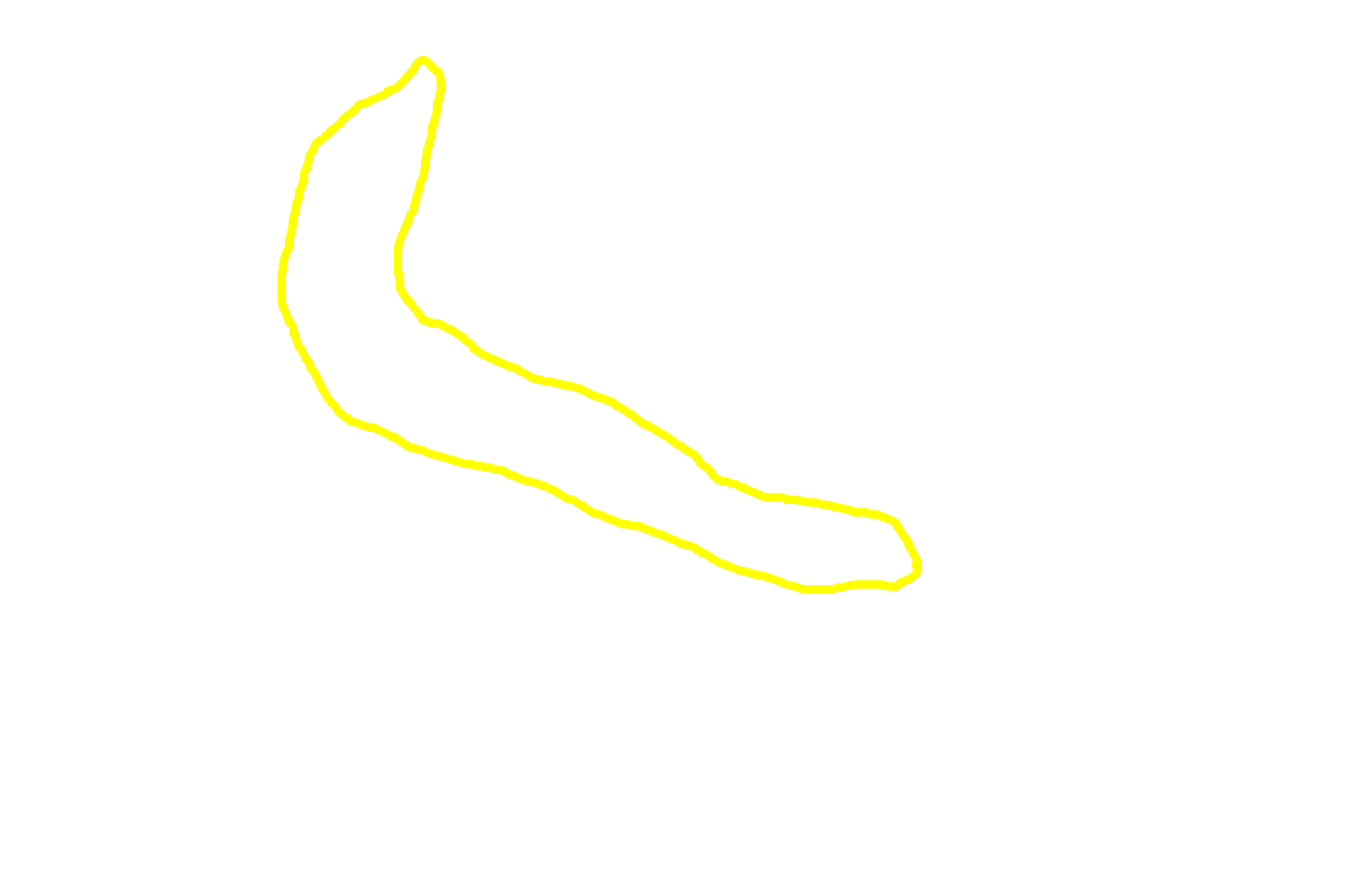  - Pars intermedia <p>This image shows a horizontal section through the human pituitary at the level indicated in the previous image.  The contrast between the pale-staining neural tissue and the deeply basophilic staining of the glandular adenohypophyseal tissue is evident.  The entire pituitary is surrounded by a dense connective tissue capsule that is continuous with the dura mater.  10x</p>
