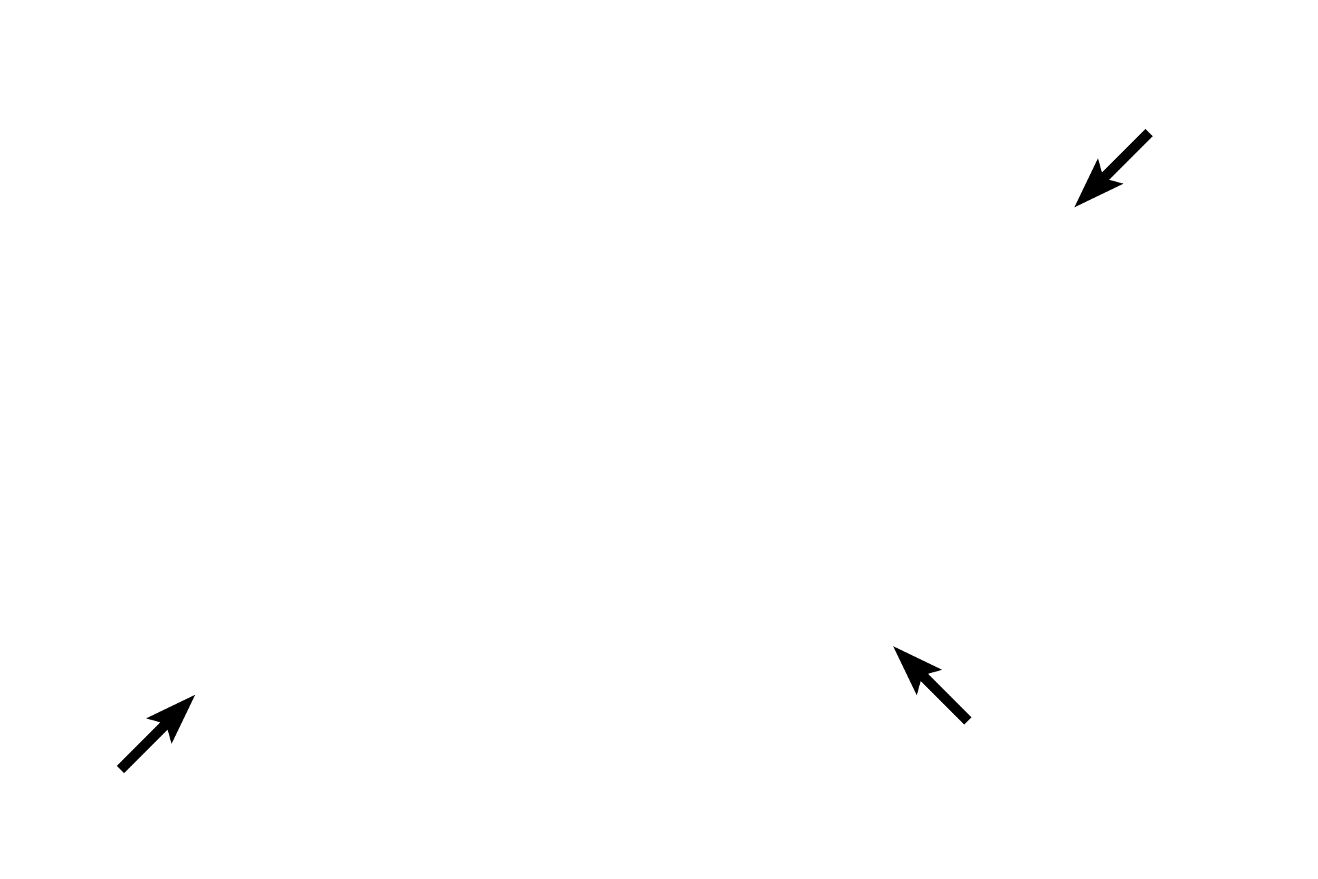 Capsule <p>This image shows a horizontal section through the human pituitary at the level indicated in the previous image.  The contrast between the pale-staining neural tissue and the deeply basophilic staining of the glandular adenohypophyseal tissue is evident.  The entire pituitary is surrounded by a dense connective tissue capsule that is continuous with the dura mater.  10x</p>
