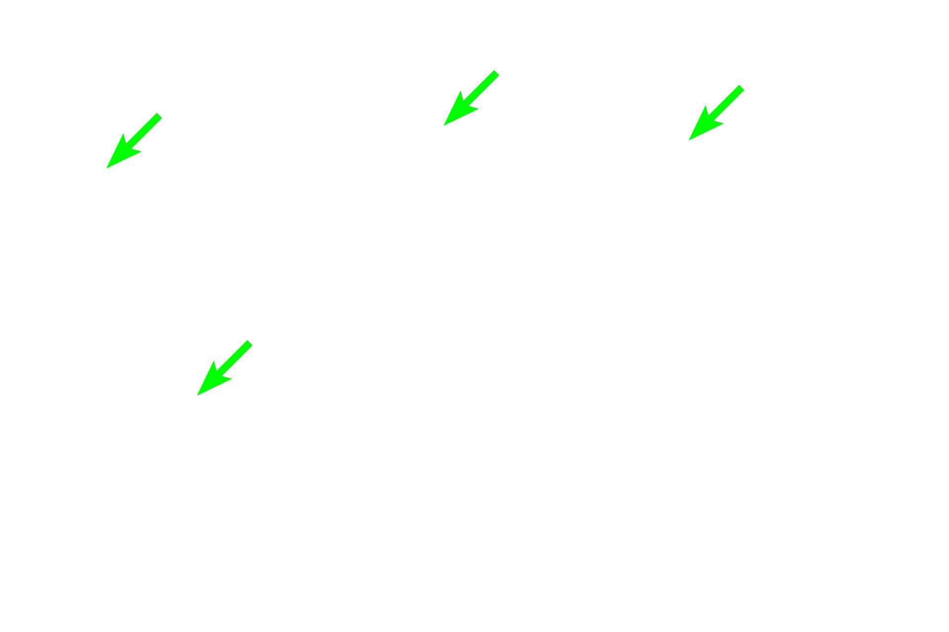  - Myenteric plexus <p>The muscularis externa is the dominant prominent main muscle layer and is formed of inner circular outer longitudinal  layers. Because swallowing is a voluntary action, the muscularis externa in the upper one-third of the esophagus is composed of skeletal muscle.  Both skeletal and smooth muscle are located in the muscularis externa in the middle third (shown here), and only smooth muscle is present in this tunic in the lower one-third. The myenteric plexus (Auerbach’s plexus), a component of the autonomic nervous system, is located between the muscle layers and innervates the muscle. </p>
