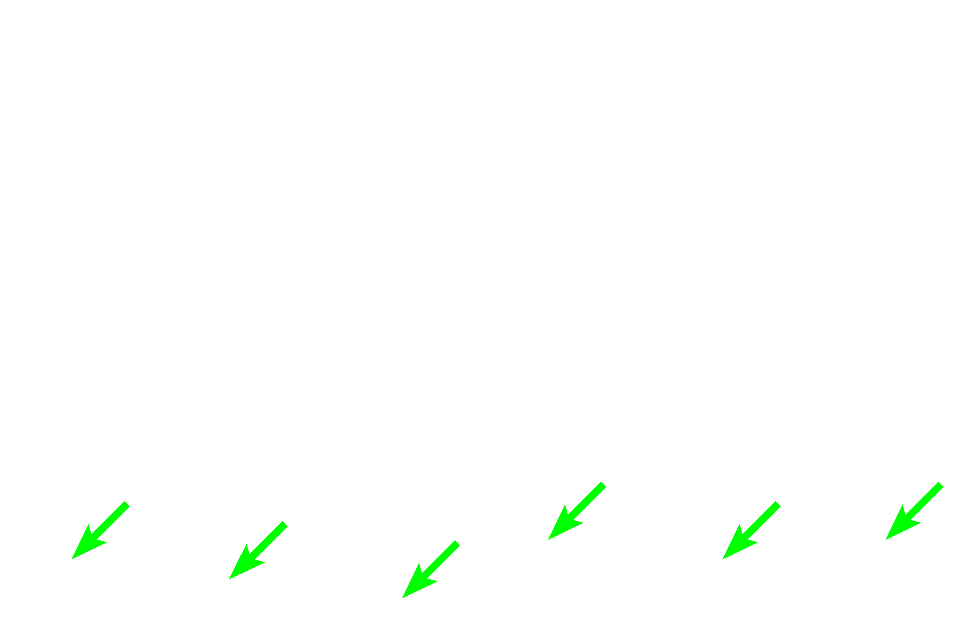 Muscularis mucosae <p>A comparison of gastric glands of the fundus/body (left) and the pyloric regions (right) demonstrates the variation in ratio of gastric pits to gastric glands in these regions.  In the fundus, gastric pits are about a quarter the length of the glands.  In the pylorus, gastric pits are longer than the glands.  40x</p>
