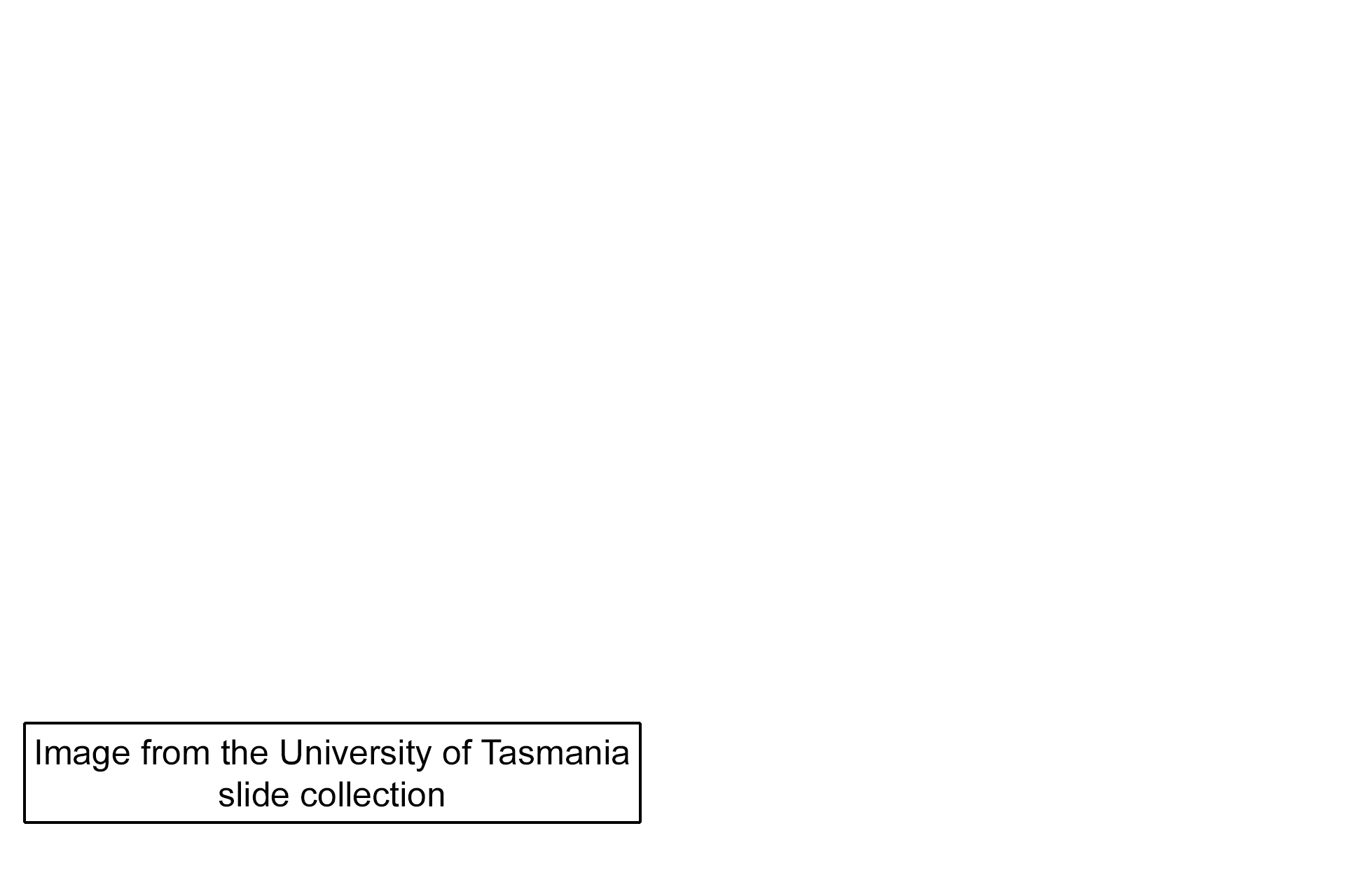 Image credit > <p>This image was taken of a slide in the University of Tasmania slide collection.</p>
