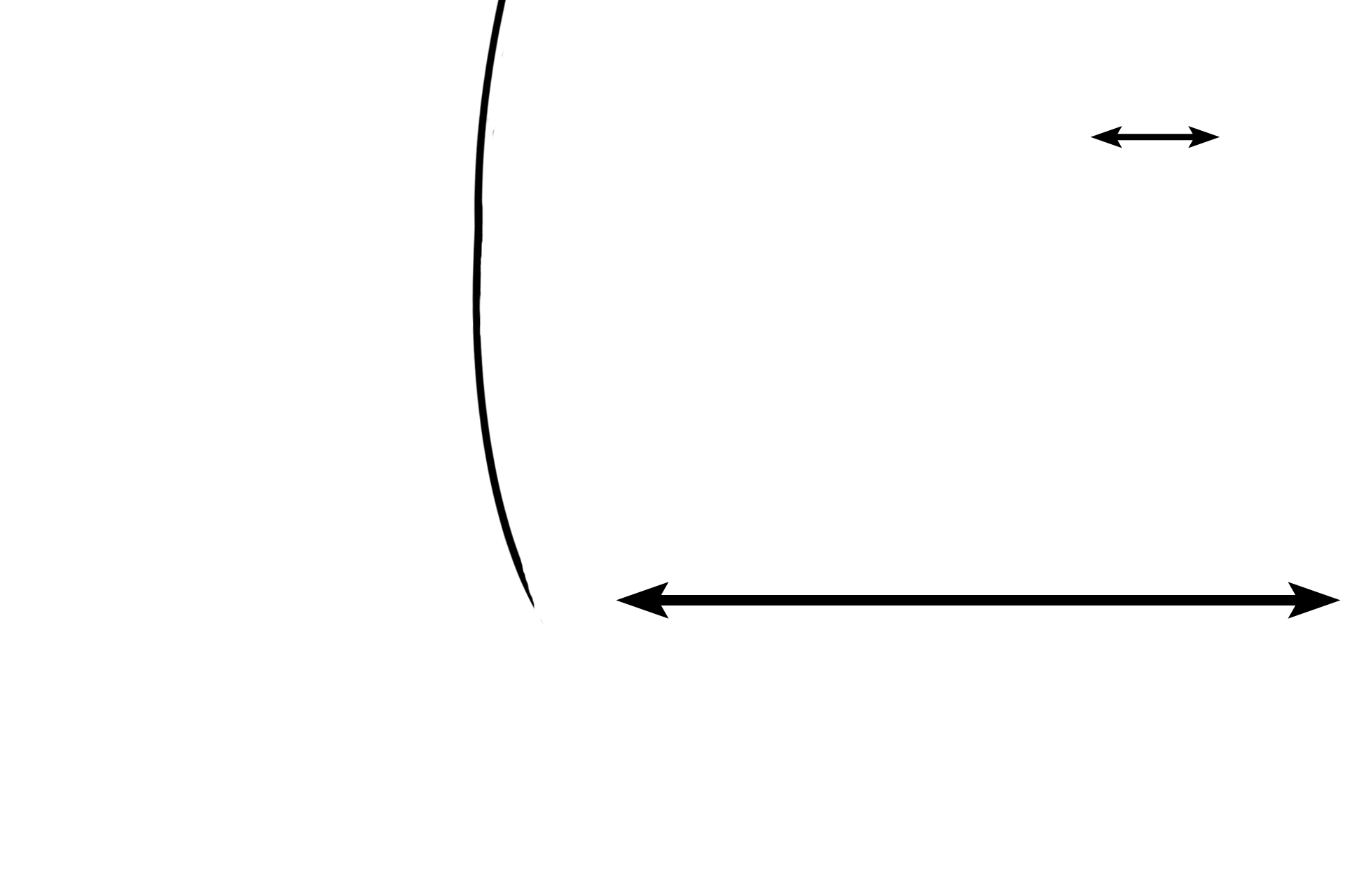 Dentin > <p>Dentin makes up the bulk of the mineralized tissues of the tooth. Dentin is less mineralized than enamel at 70% calcification. Unlike enamel, dentin is produced throughout the life of the tooth by odontoblasts. The dentin in this micrograph is demonstrating globular dentin, deposited during early dentinogenesis.  The line indicates the original margin of the enamel.  </p>

