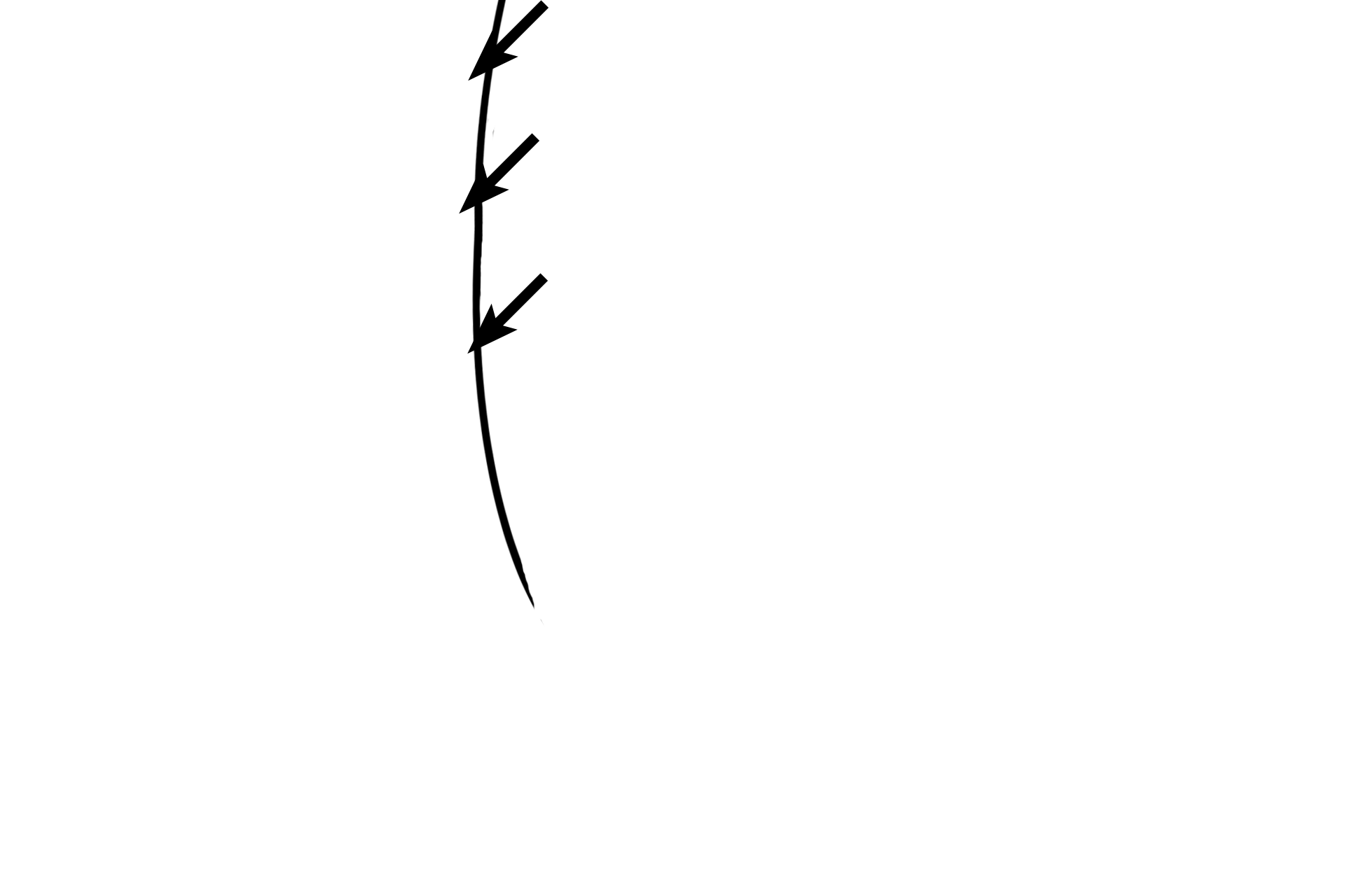 Gingival sulcus > <p>The gingival sulcus is a circular moat around the tooth and is located between the sulcular epithelium and the enamel of the tooth. The approximate margin of the enamel, lost during the preparation of this decalcified tooth, is illustrated by the line.  </p>

