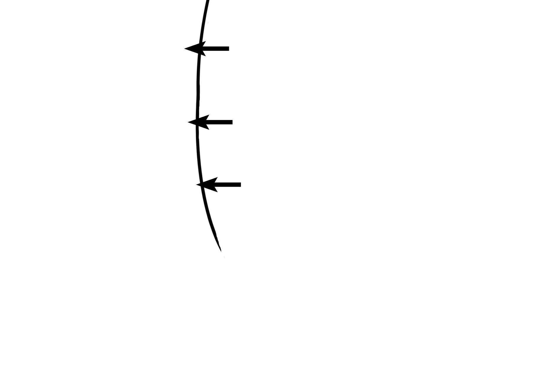 Sulcular epithelium > <p>The sulcular epithelium faces the sulcular sulcus and is composed of a stratified squamous nonkeratinized moist epithelium. The sulcular epithelium is represents a continuation of the masticatory epithelium. The line indicates the original margin of the enamel. </p>
