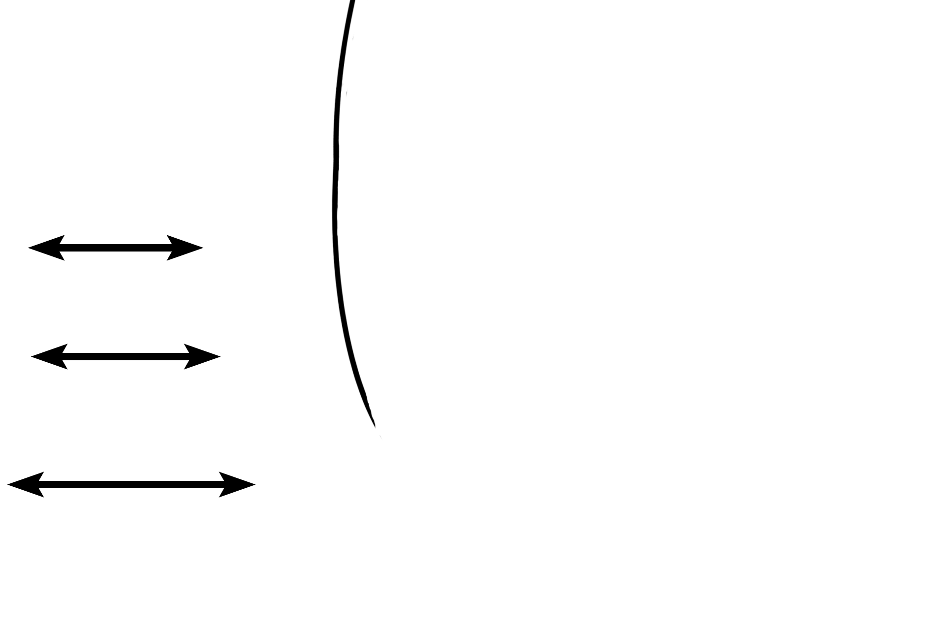 Masticatory mucosa > <p>The free and attached gingiva are covered by a masticatory mucosa with a stratified squamous orthokeratinized moist epithelium.  Its deeply indented junction with tall papillae of lamina propria greatly reduces mobility of the epithelium providing protection against sheer forces. The line indicates the original margin of the enamel. </p>
