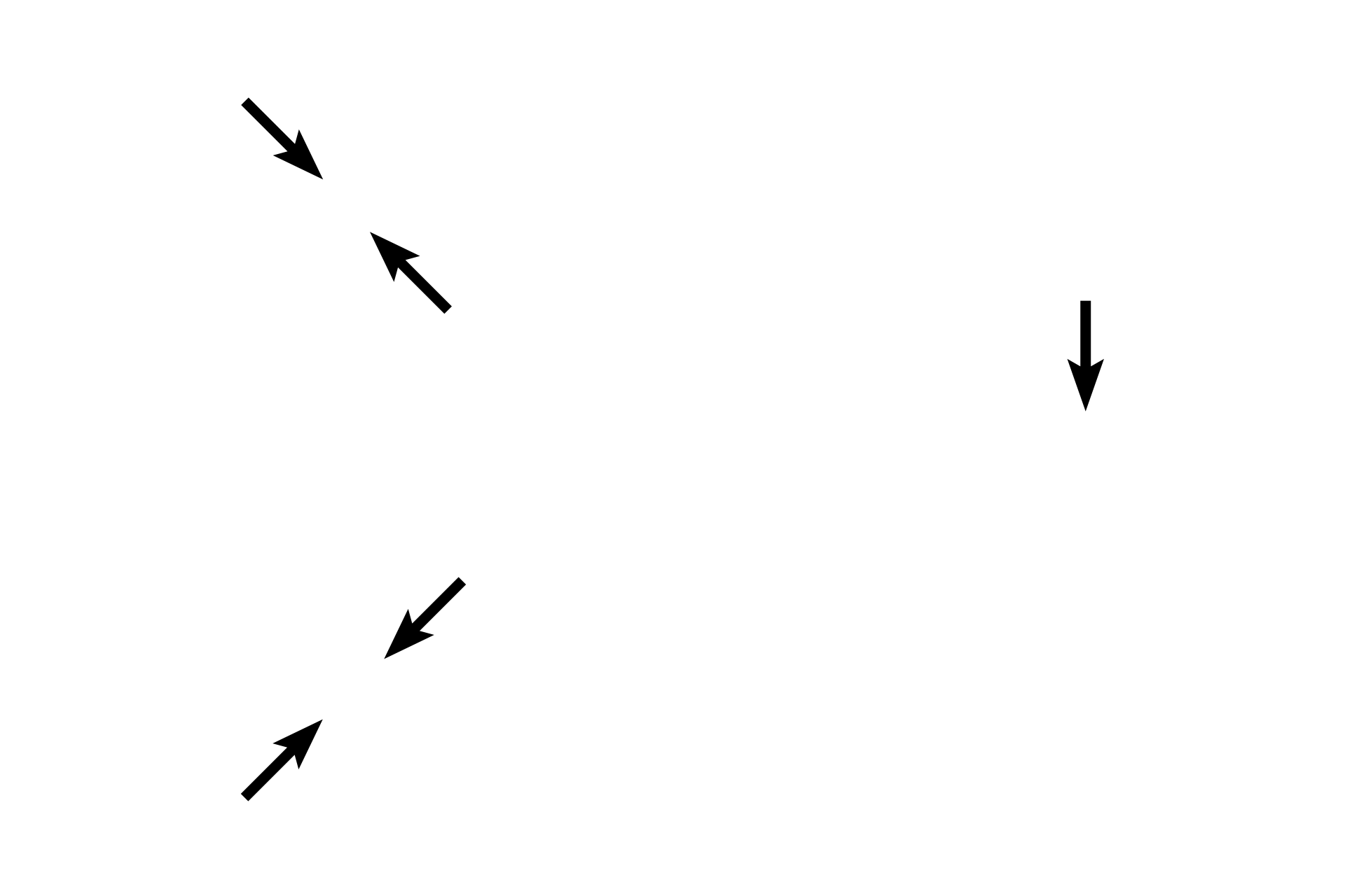 Muscularis externa <p>The appendix is a fingerlike appendage on the first portion of the large intestine. Like the large intestine, it also has straight intestinal glands and lacks villi. Abundant lymphoid tissue, both diffuse and nodular, occupies much of the lamina propria. Unlike the remainder of the large intestine, the appendix has a complete outer longitudinal muscle layer, thus lacking taeniae coli. The appendix is covered by a serosa.  100x</p>

