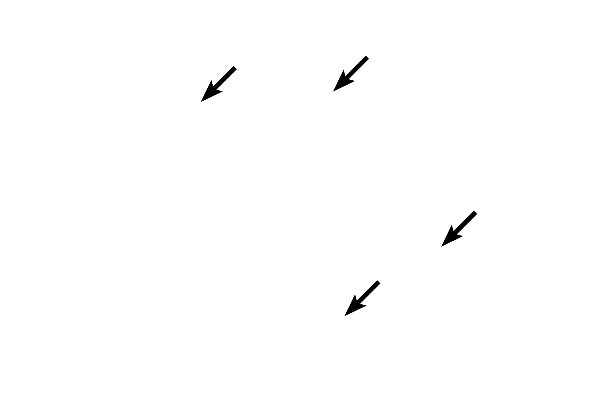  - Diffuse lymphoid tissue <p>The appendix is a fingerlike appendage on the first portion of the large intestine. Like the large intestine, it also has straight intestinal glands and lacks villi. Abundant lymphoid tissue, both diffuse and nodular, occupies much of the lamina propria. Unlike the remainder of the large intestine, the appendix has a complete outer longitudinal muscle layer, thus lacking taeniae coli. The appendix is covered by a serosa.  100x</p>
