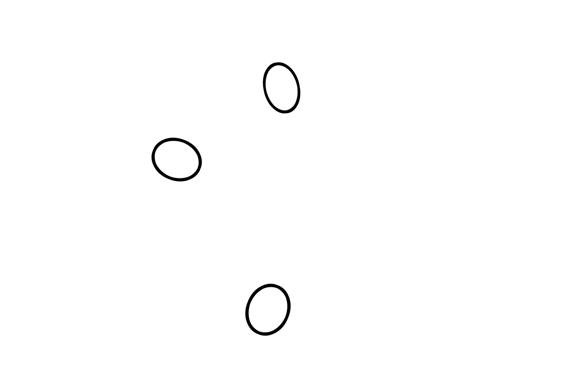  - Lymphoid nodules <p>The appendix is a fingerlike appendage on the first portion of the large intestine. Like the large intestine, it also has straight intestinal glands and lacks villi. Abundant lymphoid tissue, both diffuse and nodular, occupies much of the lamina propria. Unlike the remainder of the large intestine, the appendix has a complete outer longitudinal muscle layer, thus lacking taeniae coli. The appendix is covered by a serosa.  100x</p>
