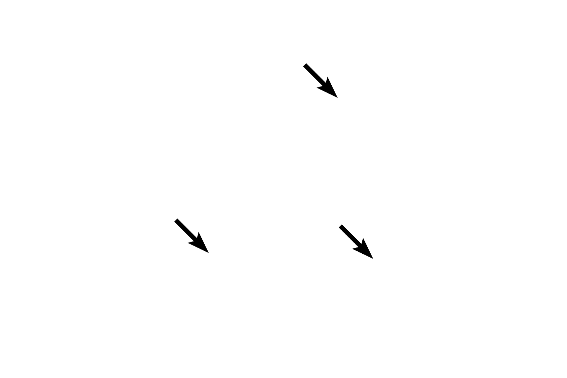  - Intestinal glands <p>The appendix is a fingerlike appendage on the first portion of the large intestine. Like the large intestine, it also has straight intestinal glands and lacks villi. Abundant lymphoid tissue, both diffuse and nodular, occupies much of the lamina propria. Unlike the remainder of the large intestine, the appendix has a complete outer longitudinal muscle layer, thus lacking taeniae coli. The appendix is covered by a serosa.  100x</p>
