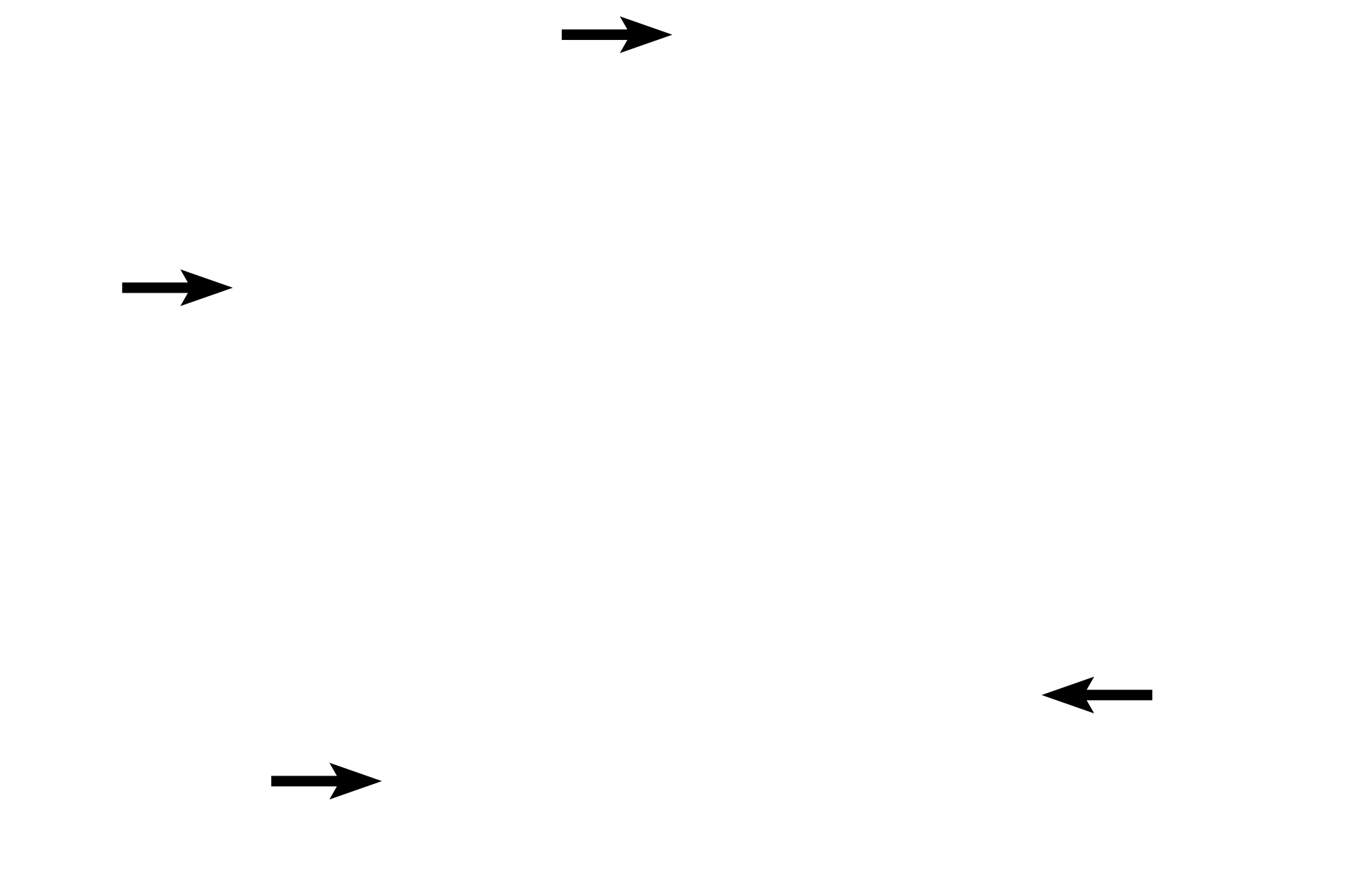 Serosa <p>The appendix is a fingerlike appendage on the first portion of the large intestine. Like the large intestine, it also has straight intestinal glands and lacks villi. Abundant lymphoid tissue, both diffuse and nodular, occupies much of the lamina propria. Unlike the remainder of the large intestine, the appendix has a complete outer longitudinal muscle layer, thus lacking taeniae coli. The appendix is covered by a serosa.  100x</p>
