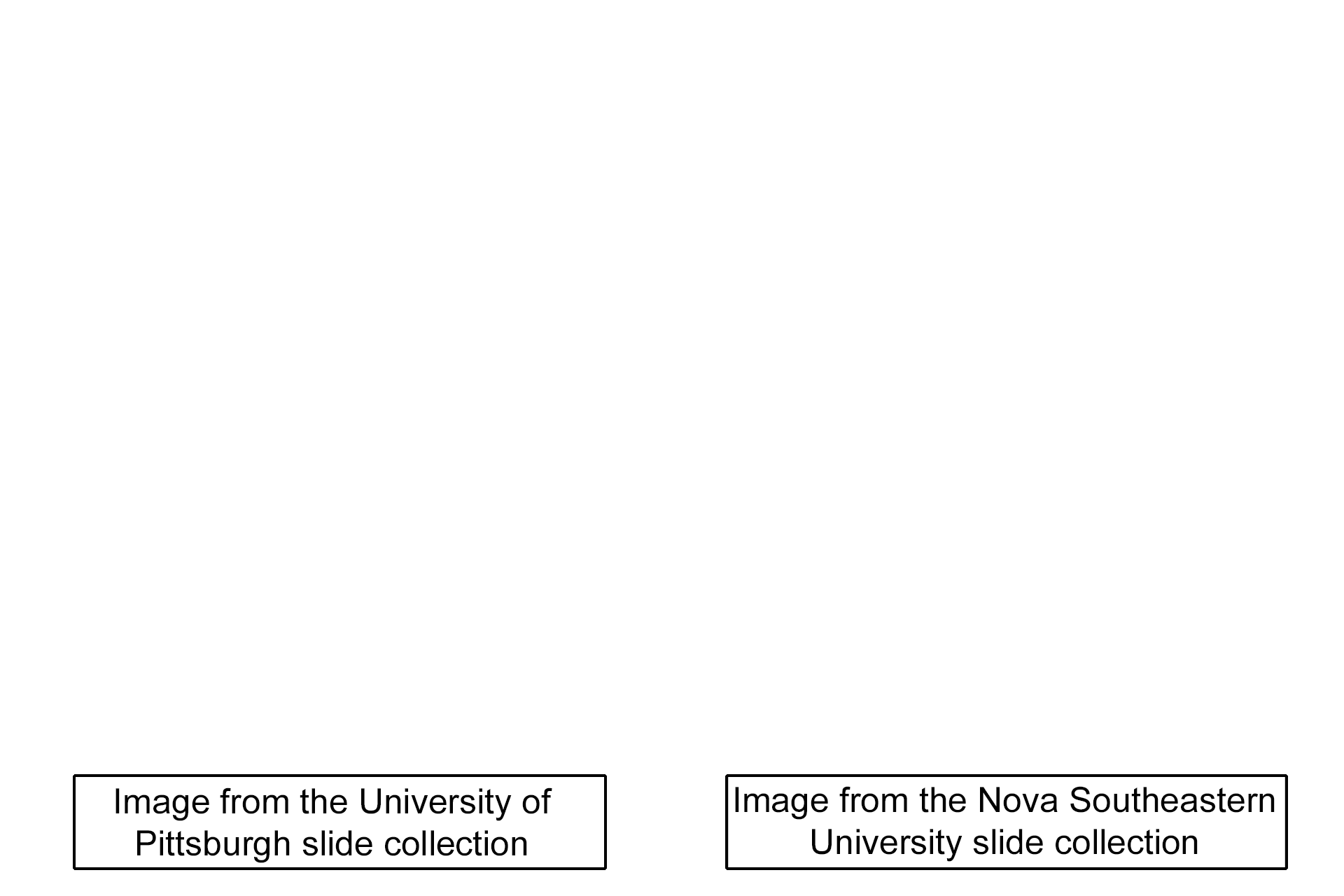 Image sources <p>These images were taken of slides in the University of Pittsburgh and Nova Southeastern University slide collections.</p>
