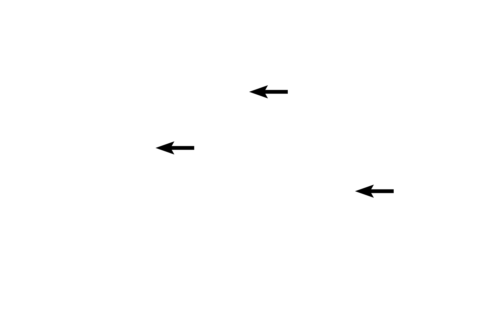 Lumen <p>The small intestine, is the longest segment of the tubular digestive tract, measuring about 6 meters (20 feet) in length.  It consists of three regions, duodenum (~25 cm), jejunum (~2.5 m) and ileum (~3.5 m) and functions in the completion of digestion and absorption of metabolites.  Like the other regions of the digestive tract in general, the small intestine is composed of a mucosa, submucosa, muscularis externa and usually a serosa.  Jejunum, 10x</p>
