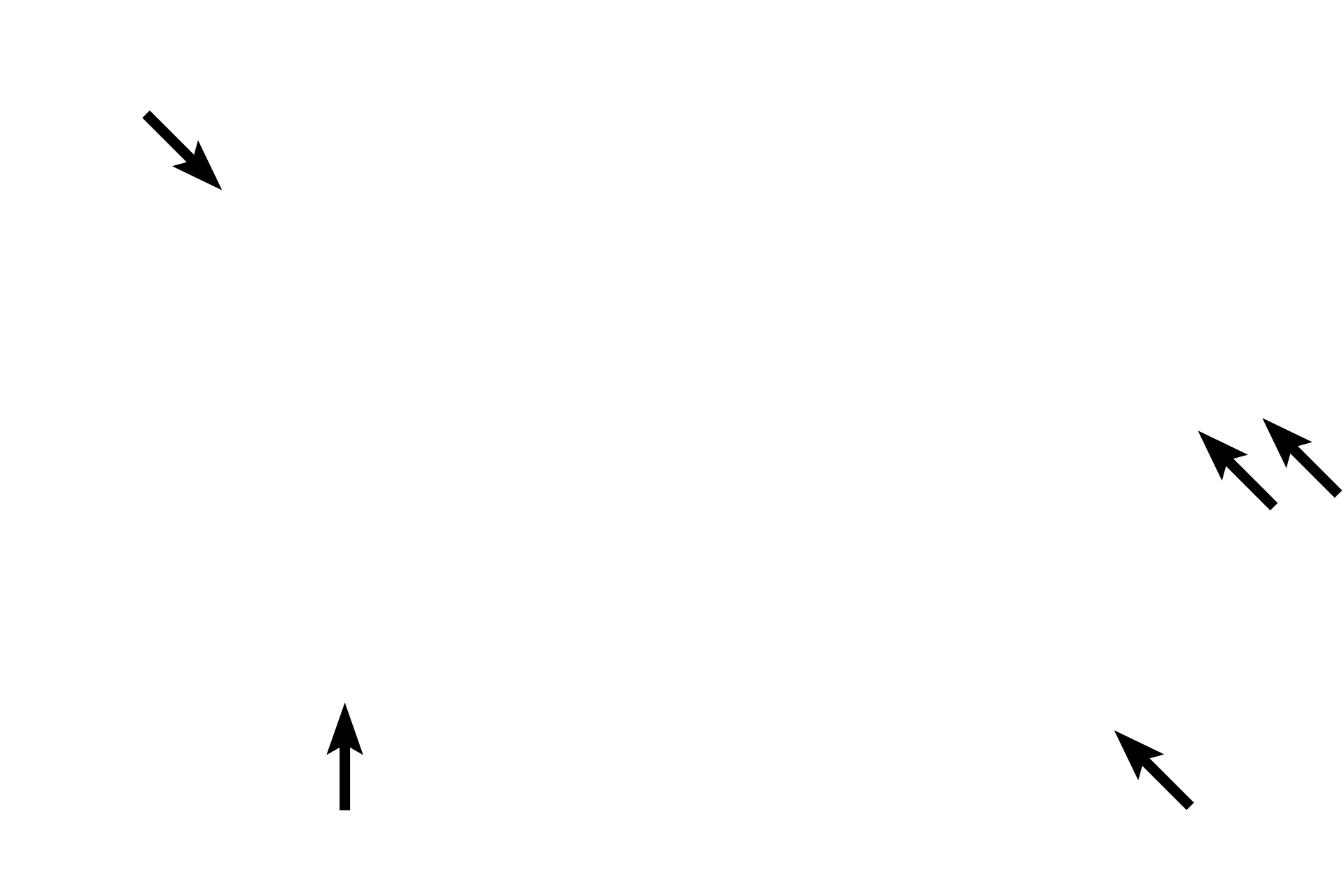 Serosa >  <p>The outermost layer of the small intestine may be either an adventitia (in the part of the duodenum that is retroperitoneal) or a serosa, in the remainder of the duodenum and in the jejunum and ileum (shown here).</p>
