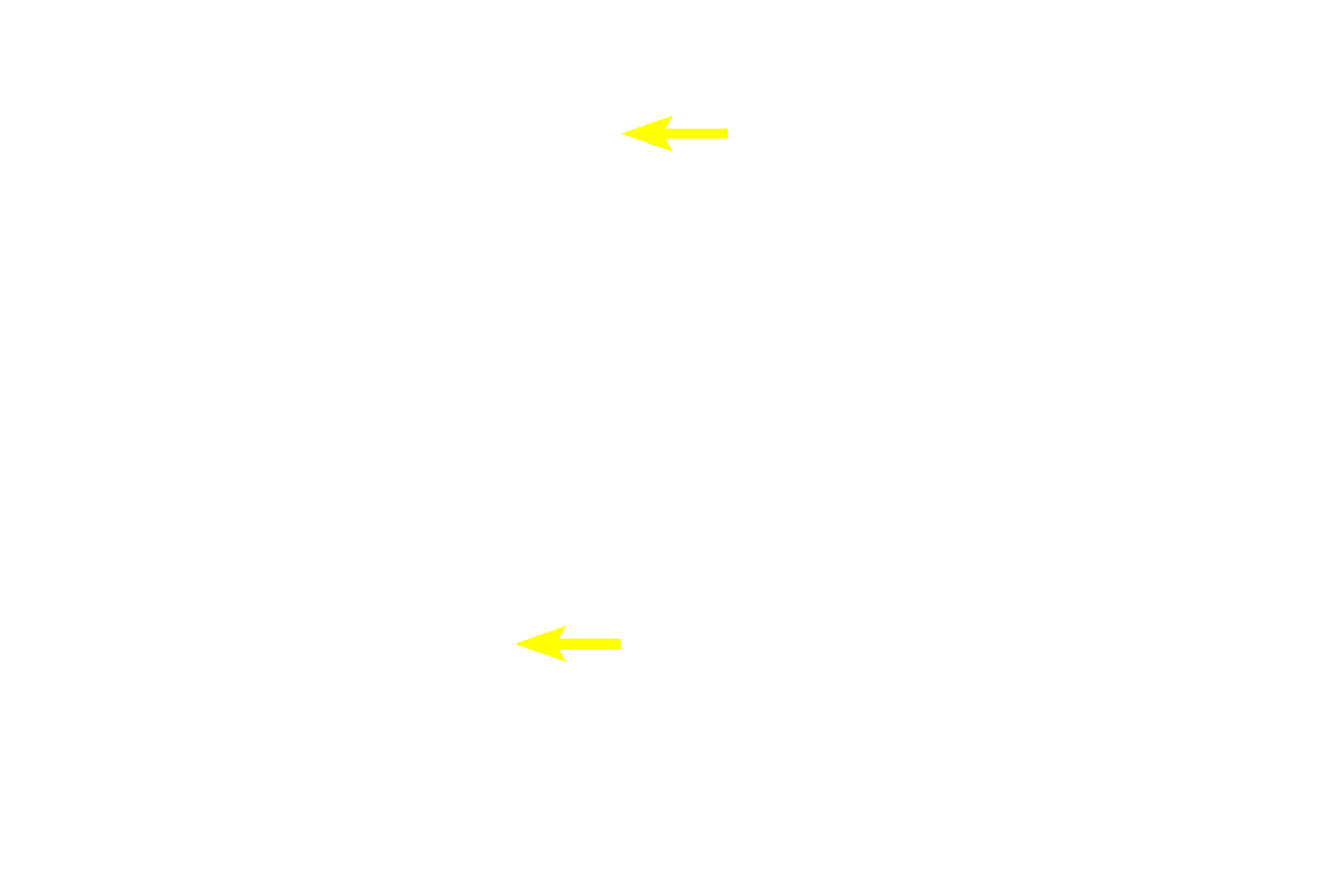  - Paneth cells <p>Intestinal glands, seen here in cross section, are formed by an epithelium composed of absorptive cells, goblet cells, Paneth cells, precursor cells and enteroendocrine (DNES) cells.  Precursor (stem) cells replenish the supply of both the absorptive and goblet cells.  When formed, these differentiated cells migrate up the intestinal glands and villi to be shed from the tips of the villi.  Intestinal glands are surrounded by lamina propria. 100x, 1000x</p>
