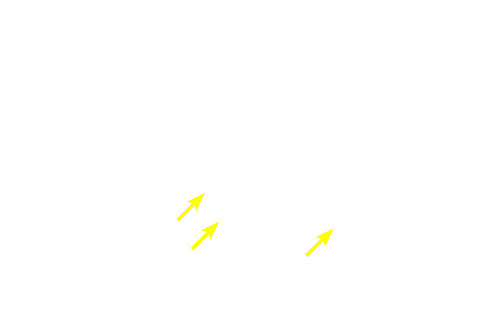  - Enteroendocrine cells <p>Intestinal glands, seen here in cross section, are formed by an epithelium composed of absorptive cells, goblet cells, Paneth cells, precursor cells and enteroendocrine (DNES) cells.  Precursor (stem) cells replenish the supply of both the absorptive and goblet cells.  When formed, these differentiated cells migrate up the intestinal glands and villi to be shed from the tips of the villi.  Intestinal glands are surrounded by lamina propria. 100x, 1000x</p>
