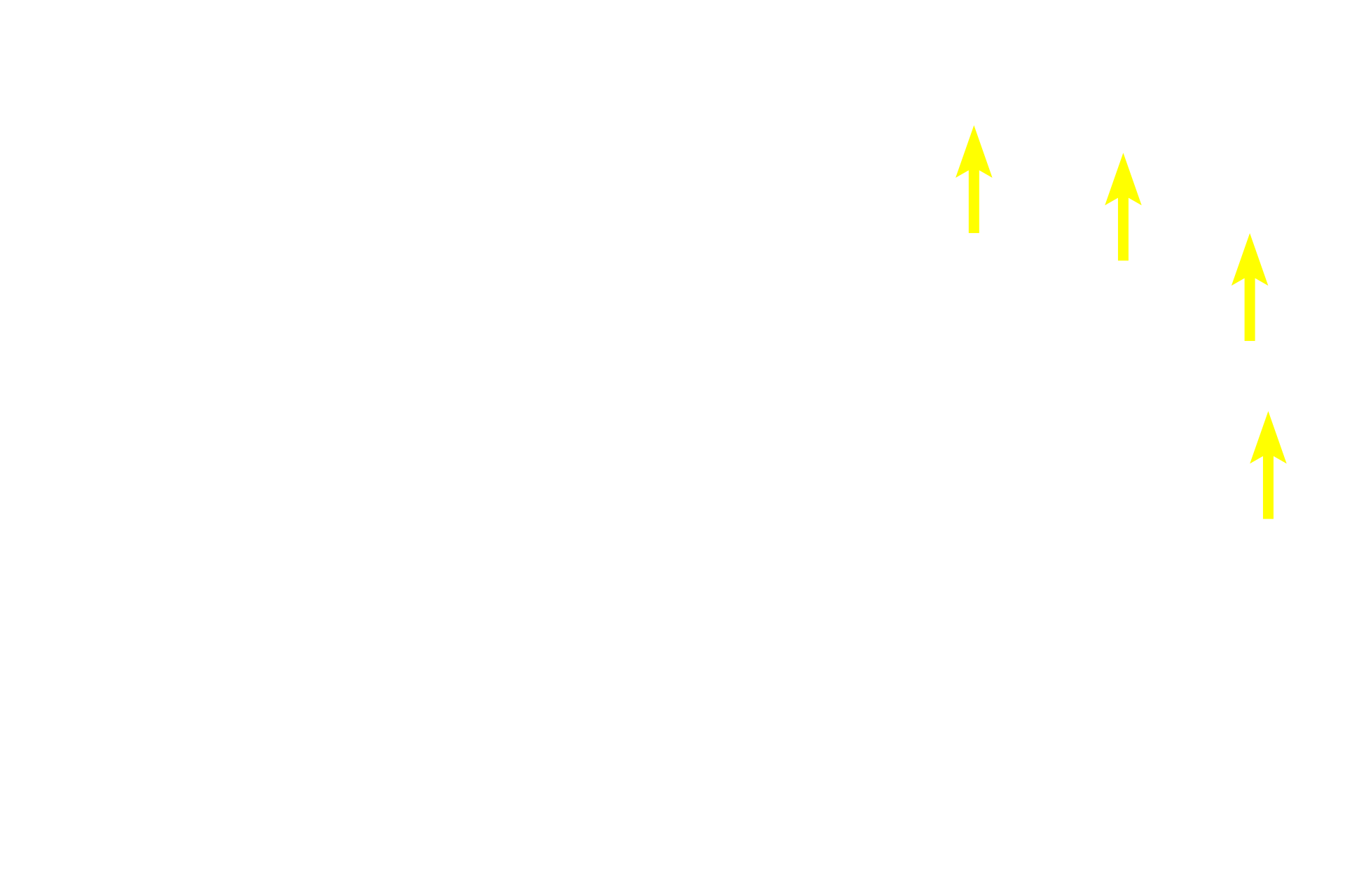 Nodule aggregate (Peyer’s patch) > <p>Nodule aggregates (Peyer’s patches) are common in the lamina propria of the ileum on the side opposite the mesentery.  They consist of both diffuse and nodular lymphoid tissues. </p>
