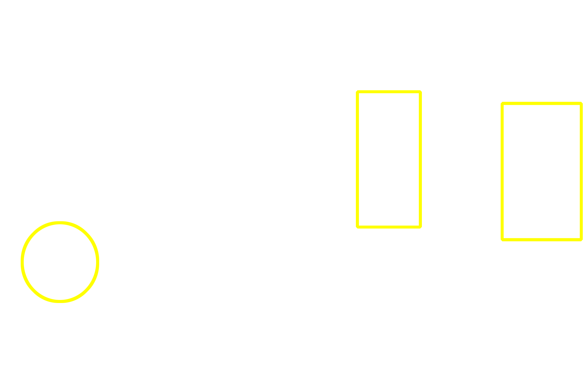 - Lymphoid nodules <p>Mucosa-associated lymphoid tissue (MALT) is present all along the length of the tubular digestive tract and consists of both diffuse and nodular lymphoid tissue.  Large accumulations of MALT, Peyer’s patches, are particularly prominent in the lamina propria of the ileum as shown in these images.  Larger lymphoid nodules often extend into the submucosa.  MALT filters tissue fluid, detecting foreign antigens and initiating an immune response. 50x, 10x </p>
