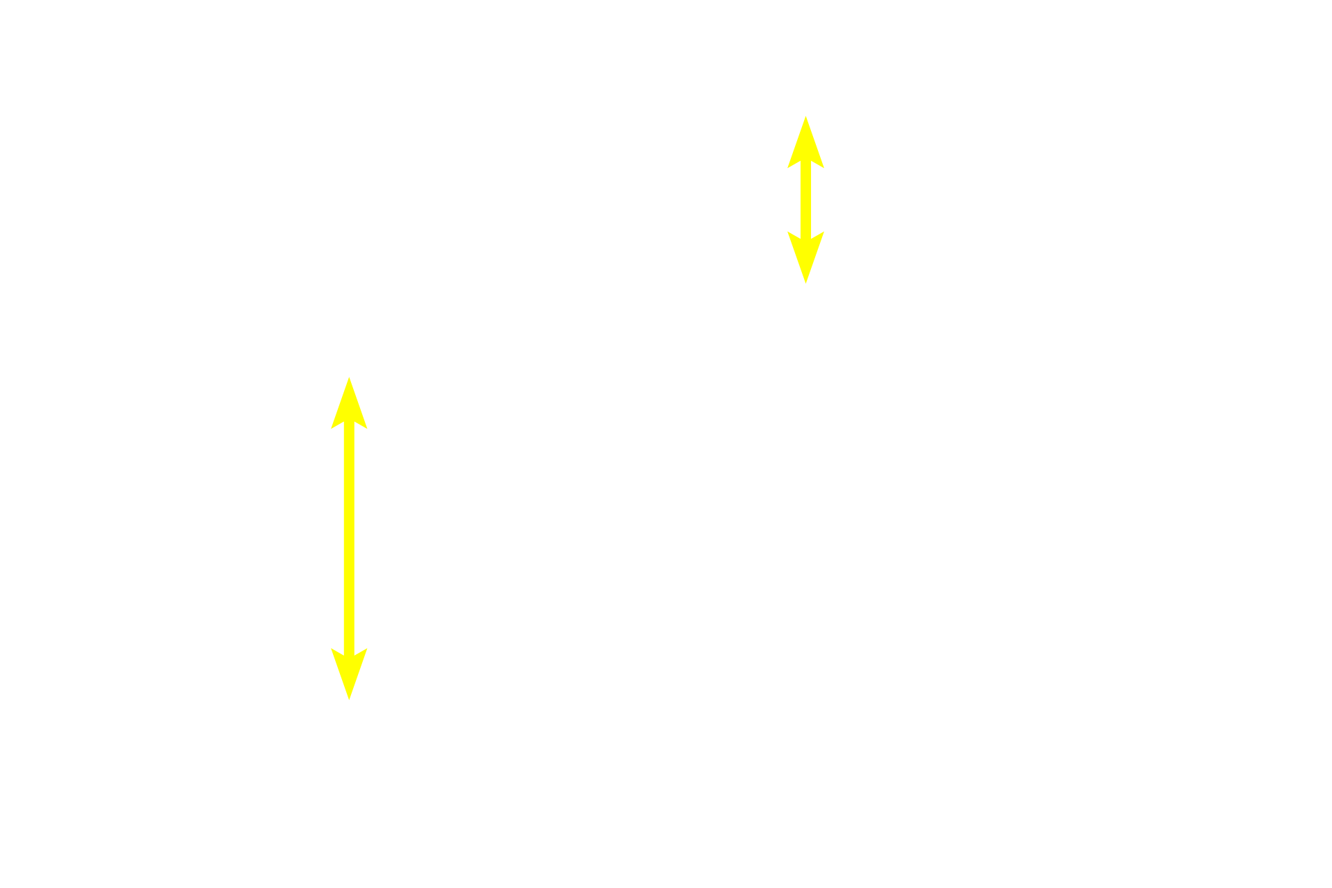 Mucosa <p>Mucosa-associated lymphoid tissue (MALT) is present all along the length of the tubular digestive tract and consists of both diffuse and nodular lymphoid tissue.  Large accumulations of MALT, Peyer’s patches, are particularly prominent in the lamina propria of the ileum as shown in these images.  Larger lymphoid nodules often extend into the submucosa.  MALT filters tissue fluid, detecting foreign antigens and initiating an immune response. 50x, 10x </p>
