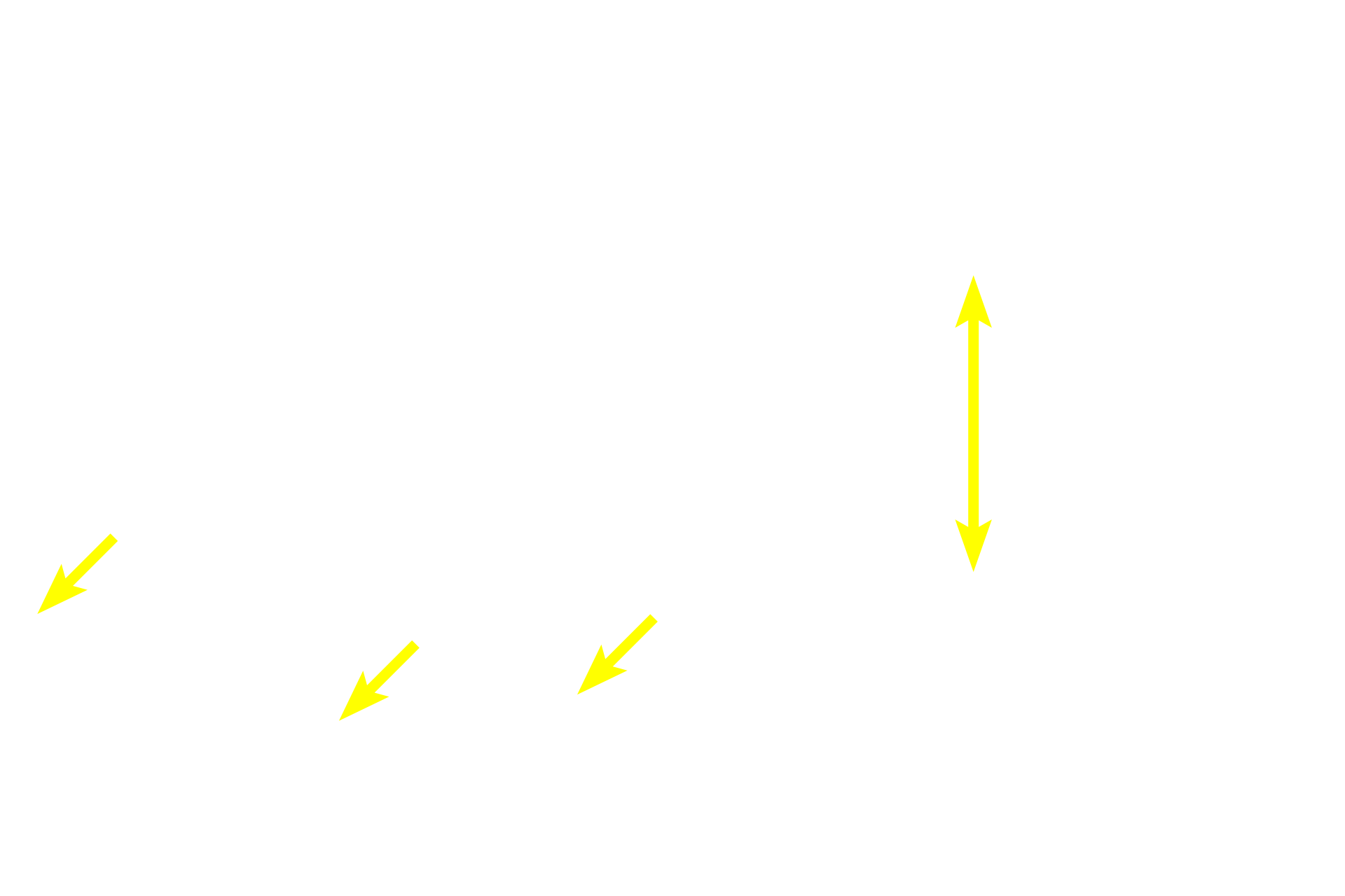 Submucosa <p>Mucosa-associated lymphoid tissue (MALT) is present all along the length of the tubular digestive tract and consists of both diffuse and nodular lymphoid tissue.  Large accumulations of MALT, Peyer’s patches, are particularly prominent in the lamina propria of the ileum as shown in these images.  Larger lymphoid nodules often extend into the submucosa.  MALT filters tissue fluid, detecting foreign antigens and initiating an immune response. 50x, 10x </p>
