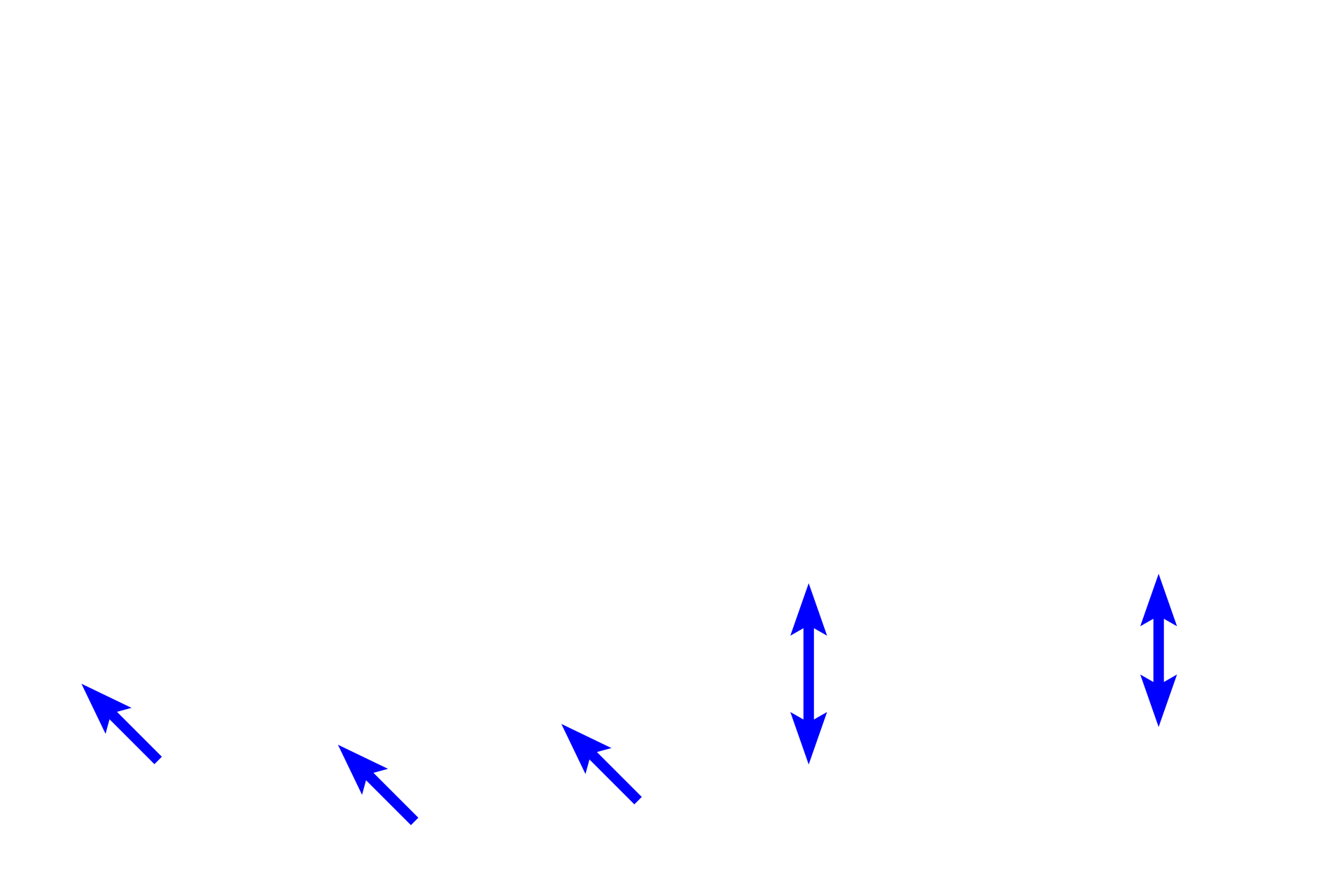 Muscularis externa <p>Mucosa-associated lymphoid tissue (MALT) is present all along the length of the tubular digestive tract and consists of both diffuse and nodular lymphoid tissue.  Large accumulations of MALT, Peyer’s patches, are particularly prominent in the lamina propria of the ileum as shown in these images.  Larger lymphoid nodules often extend into the submucosa.  MALT filters tissue fluid, detecting foreign antigens and initiating an immune response. 50x, 10x </p>
