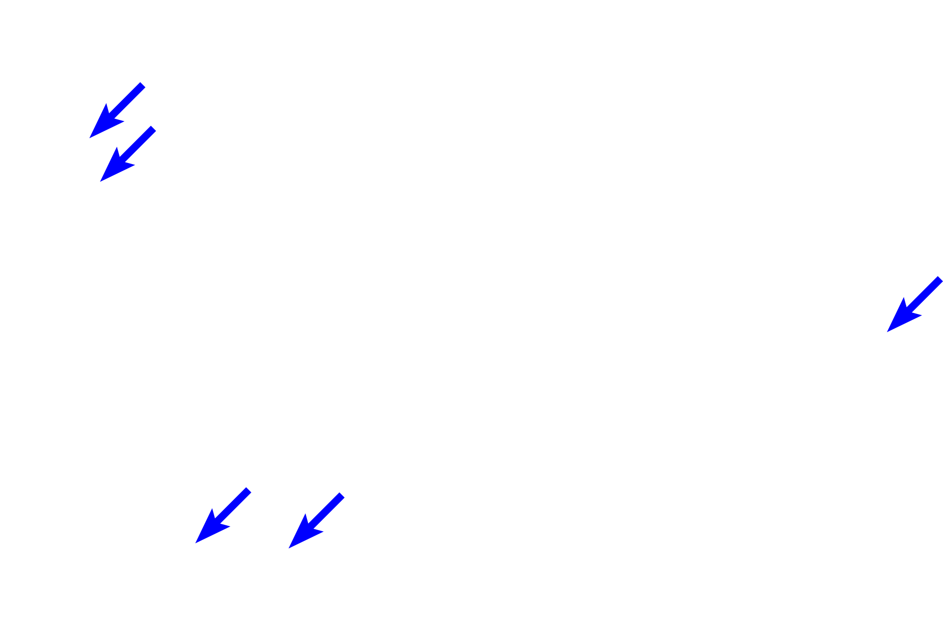  - Submucosal (Meissner’s) plexus <p>The submucosa consists of dense, irregular connective tissue containing larger blood vessels, nerves and lymphatics. In addition, the submucosa also contains the submucosal (Meissner’s) plexus which innervates the smooth muscle of the muscularis mucosae and regulates glandular secretions.  200x</p>
