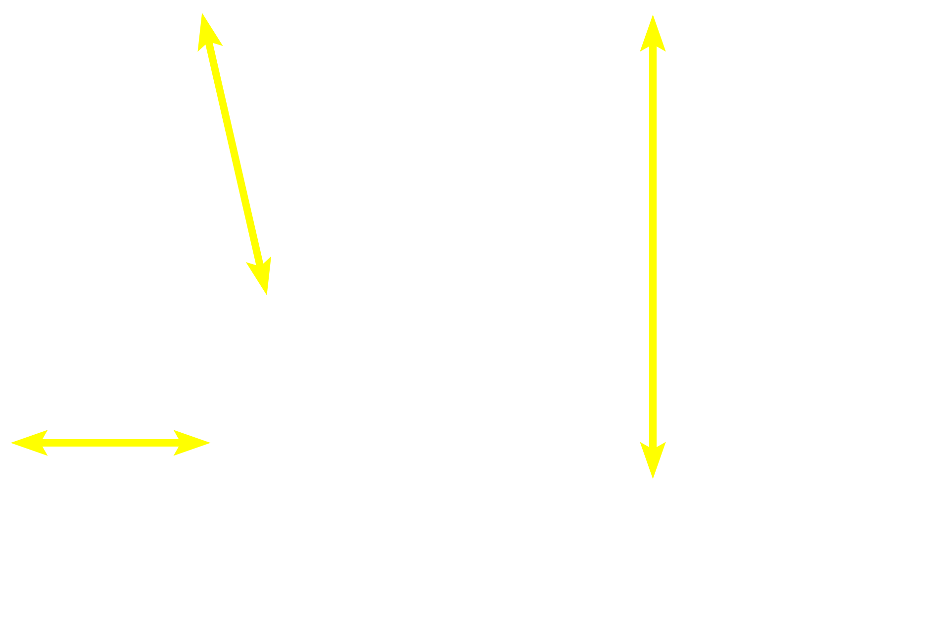 Mucosa <p>These images show submucosal glands (Brunner’s glands), which are only present in the duodenum portion of the small intestine; their presence can be used to distinguish the duodenum from the jejunum or ileum.  Ducts from these glands pass through the muscularis mucosae to empty into the bases of intestinal glands. These submucosal glands produce an alkaline mucus that helps neutralize the acidity of the chyme entering the duodenum from the stomach.  The duodenum also receives the secretions of the exocrine pancreas and liver. 100x, 200x</p>
