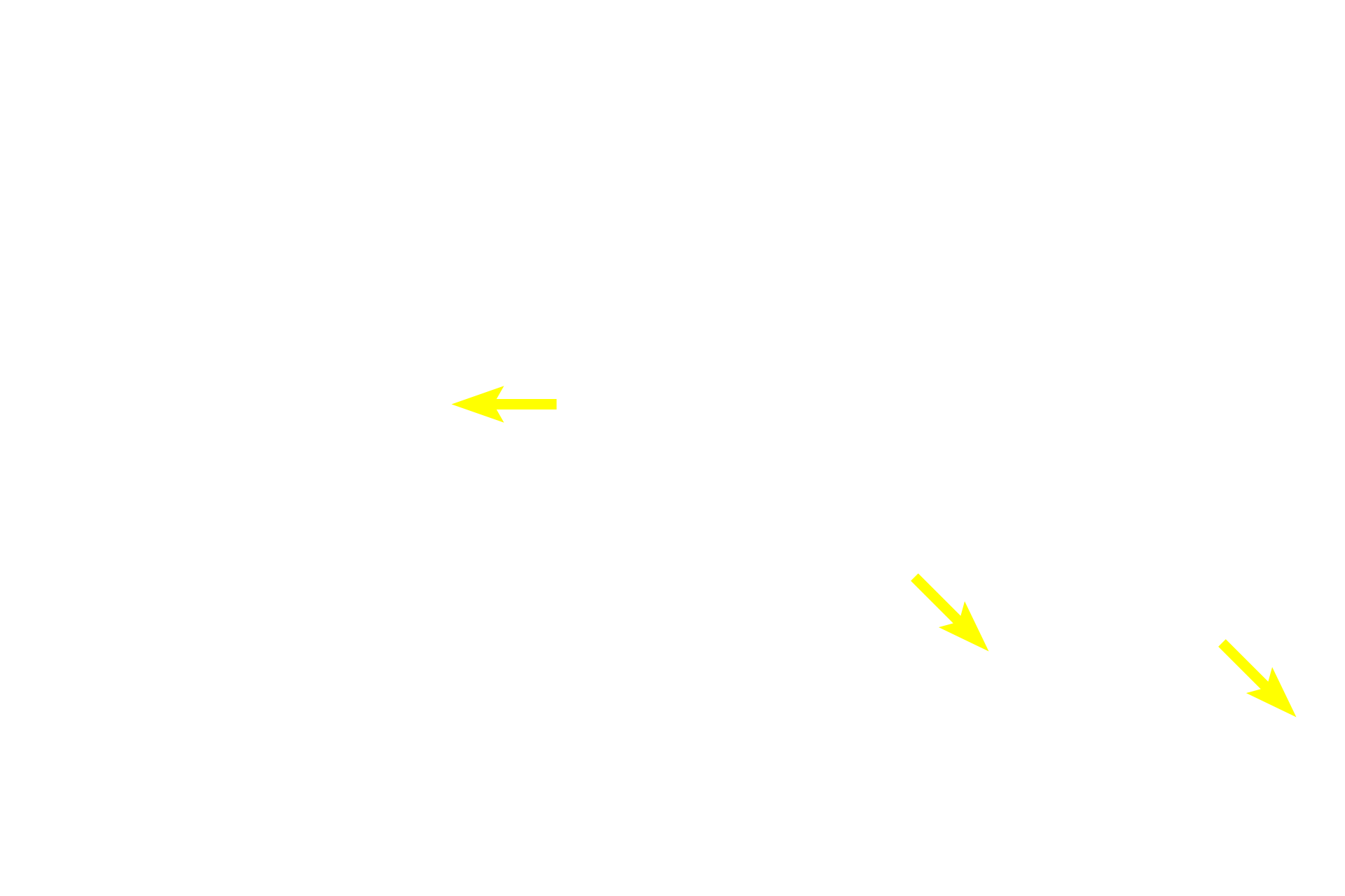  - Connection with intestinal glands <p>These images show submucosal glands (Brunner’s glands), which are only present in the duodenum portion of the small intestine; their presence can be used to distinguish the duodenum from the jejunum or ileum.  Ducts from these glands pass through the muscularis mucosae to empty into the bases of intestinal glands. These submucosal glands produce an alkaline mucus that helps neutralize the acidity of the chyme entering the duodenum from the stomach.  The duodenum also receives the secretions of the exocrine pancreas and liver. 100x, 200x</p>
