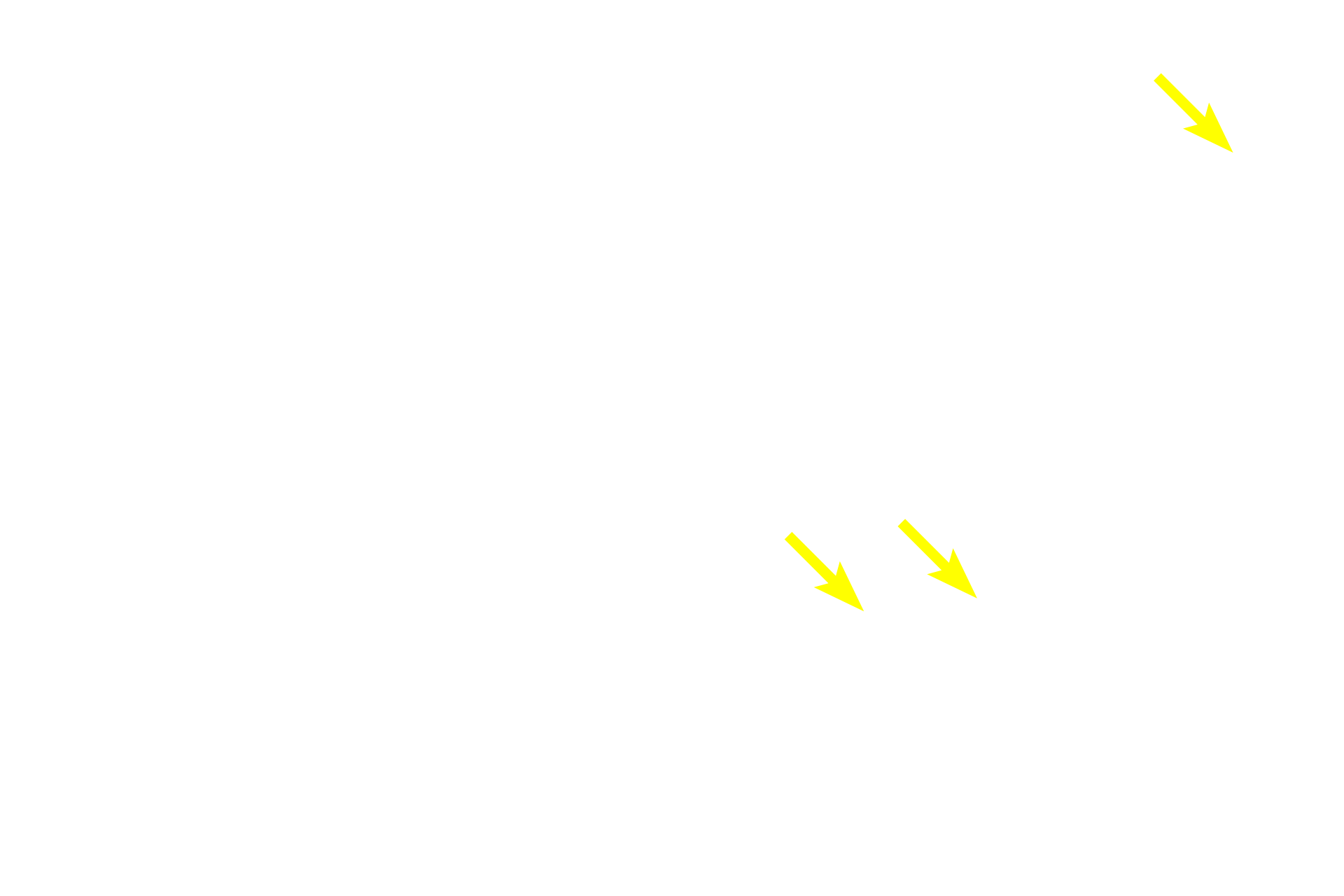  - Unmyelinated axons <p>The submucosal plexus is the smaller component of the enteric nervous system and its ganglia are located near the mucosa as well as adjacent to the inner layer of the muscularis externa. </p>
