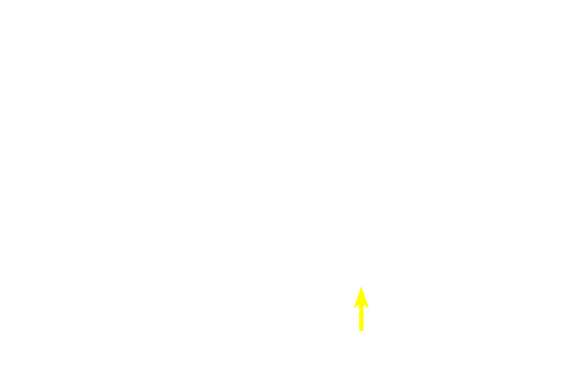  - Supporting cell <p>The submucosal plexus is the smaller component of the enteric nervous system and its ganglia are located near the mucosa as well as adjacent to the inner layer of the muscularis externa. </p>

