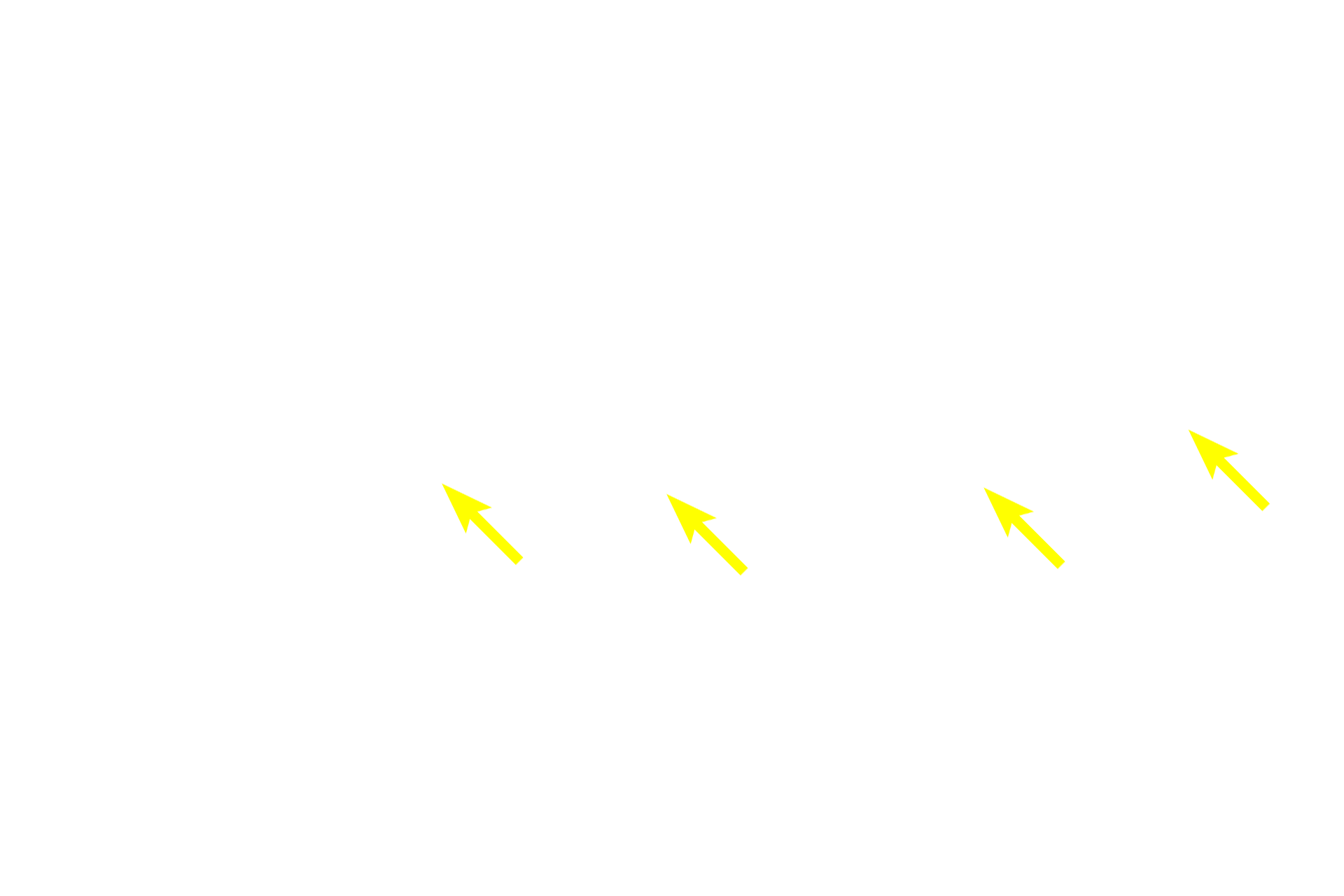  - Supporting cells <p>The myenteric plexus is the second and larger component of the autonomic innervation of the digestive tract.  Like the submucosal plexus, it consists of neurons in ganglia that are interconnected by a network of unmyelinated axons.  This plexus innervates both layers of the muscularis externa from the esophagus to the rectum and is principally responsible for peristaltic movements and segmentation (mixing). 10x, 600x</p>

