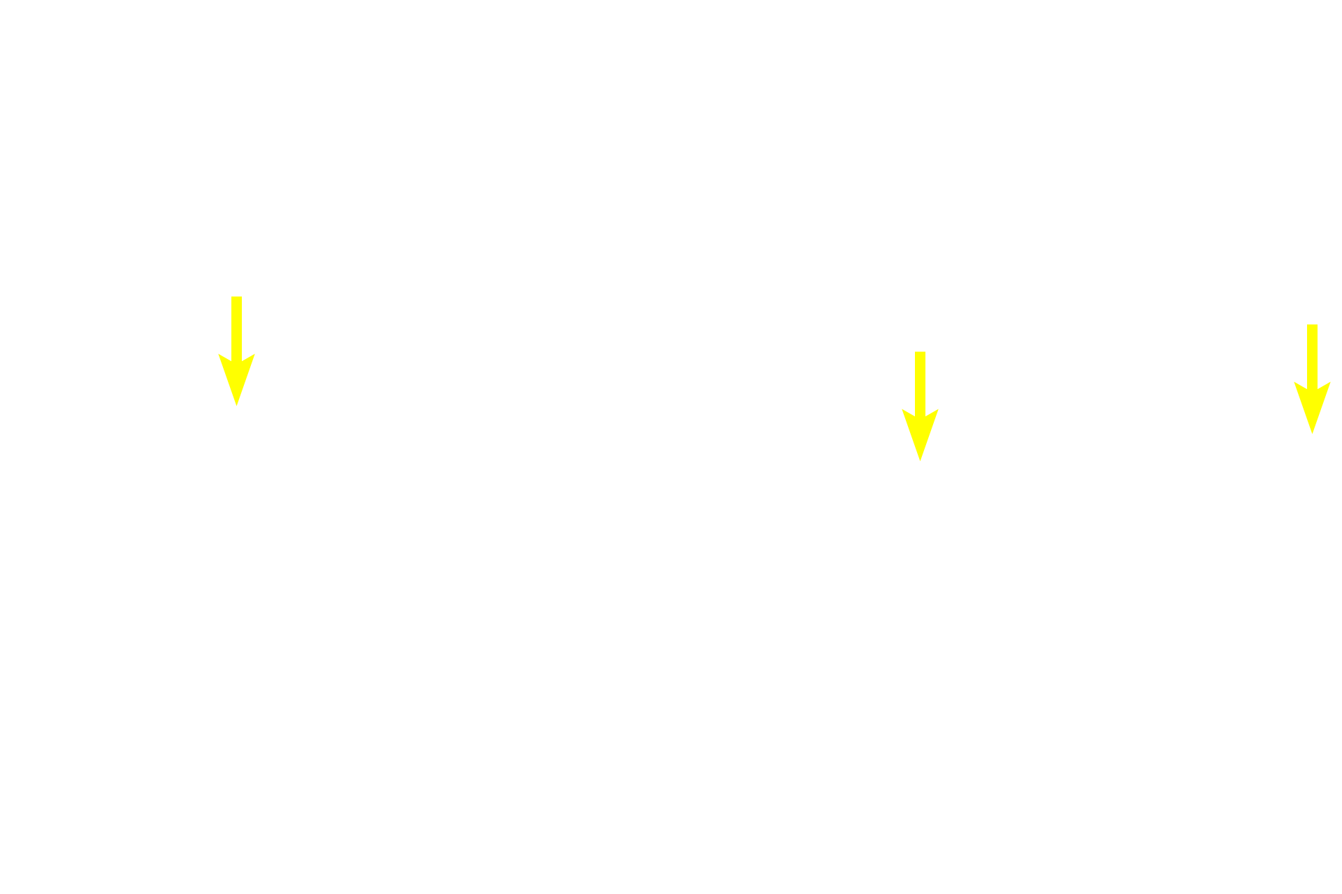  - Unmyelinated axons <p>The myenteric plexus is the second and larger component of the autonomic innervation of the digestive tract.  Like the submucosal plexus, it consists of neurons in ganglia that are interconnected by a network of unmyelinated axons.  This plexus innervates both layers of the muscularis externa from the esophagus to the rectum and is principally responsible for peristaltic movements and segmentation (mixing). 10x, 600x</p>
