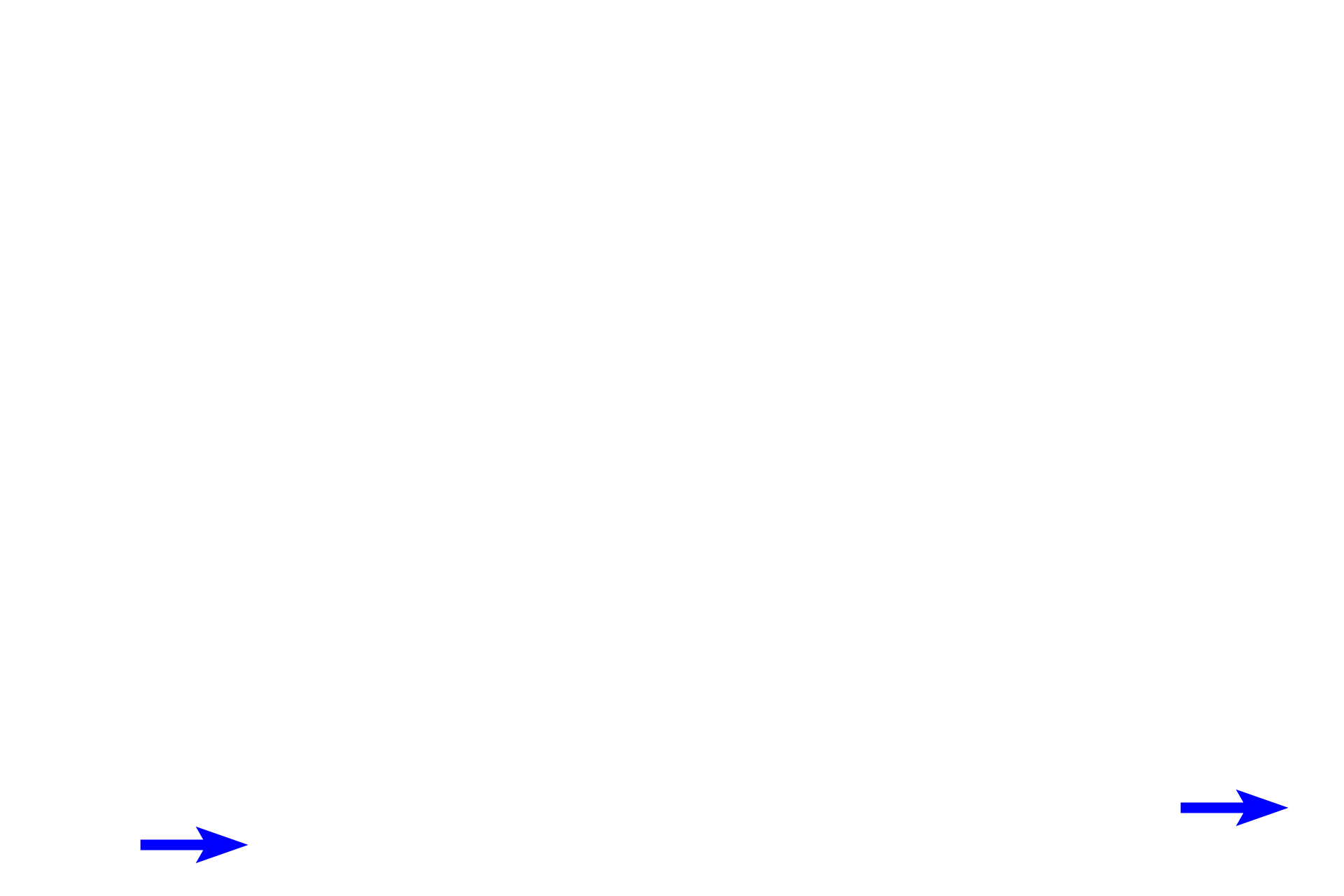 Serosa <p>A section of the jejunum displays the four layers of the small intestine (mucosa, submucosa, muscularis externa and serosa), including structures that increase surface area, villi and plicae circulares. Villi have a core of lamina propria covered by the intestinal epithelium, including microvilli on absorptive cells. Each plica has a core of submucosa that is overlain by all mucosal layers, including villi.  Jejunum, 40x</p>
