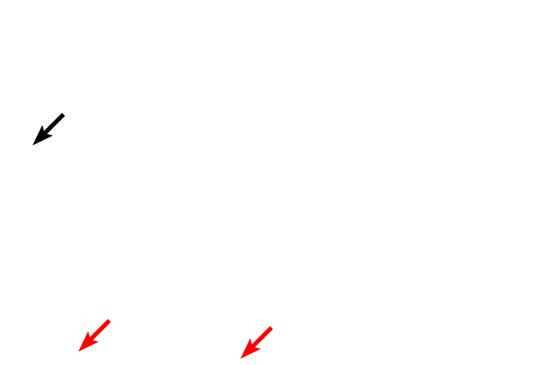 Serosa <p>Plica circulares are clearly shown in this longitudinal section of the jejunum.  Plica circulares provide increased absorptive surface area for the intestine.  They consist of circular folds comprised of a central core of submucosa covered by the mucosa with its villi and glands. The mucosa also contains collections of lymphoid tissues, referred to as mucosa-associated lymphoid tissue (MALT).  Jejunum, 40x </p>
