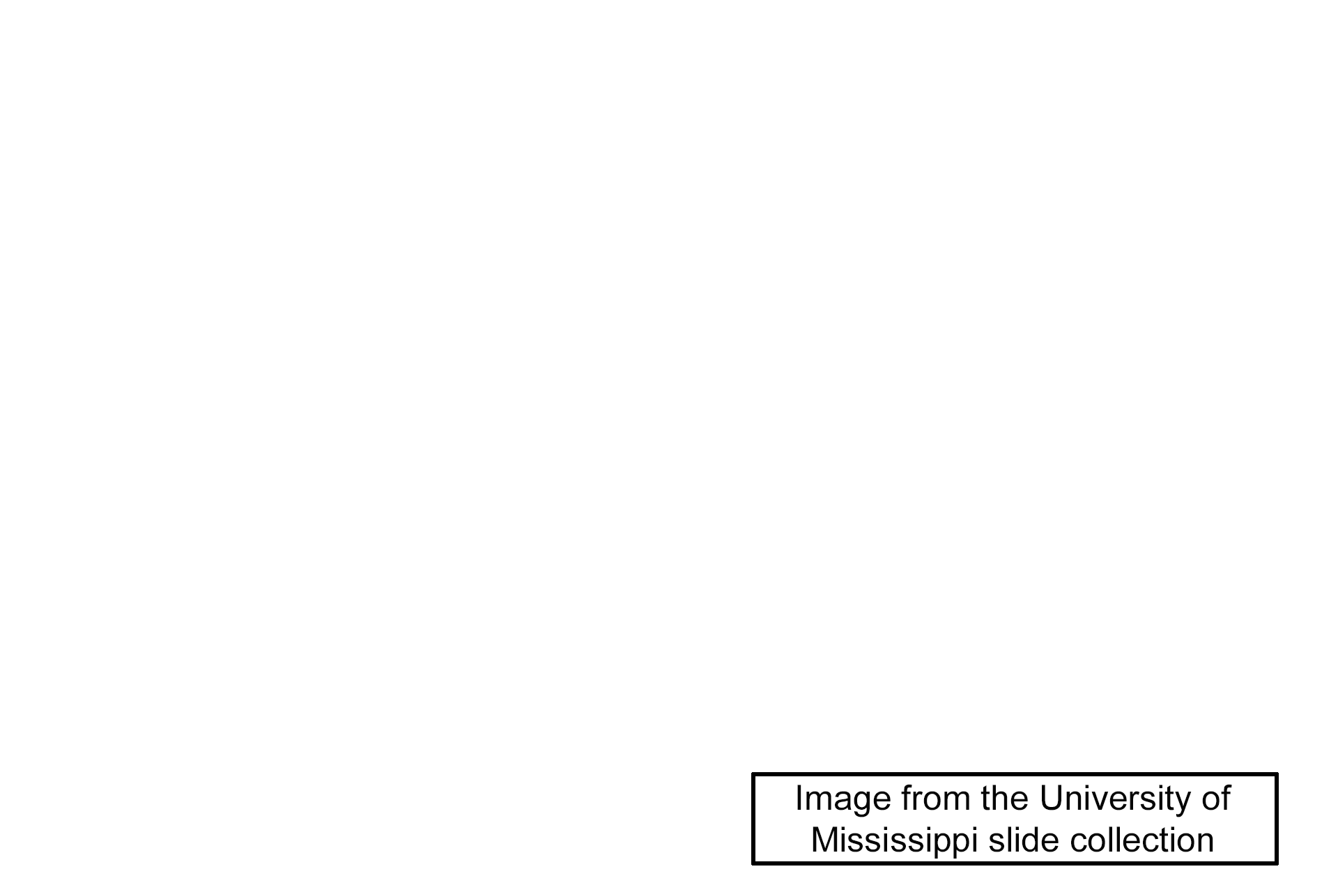 Image source > <p>This image was taken of a slide in the University of Mississippi slide collection.</p>
