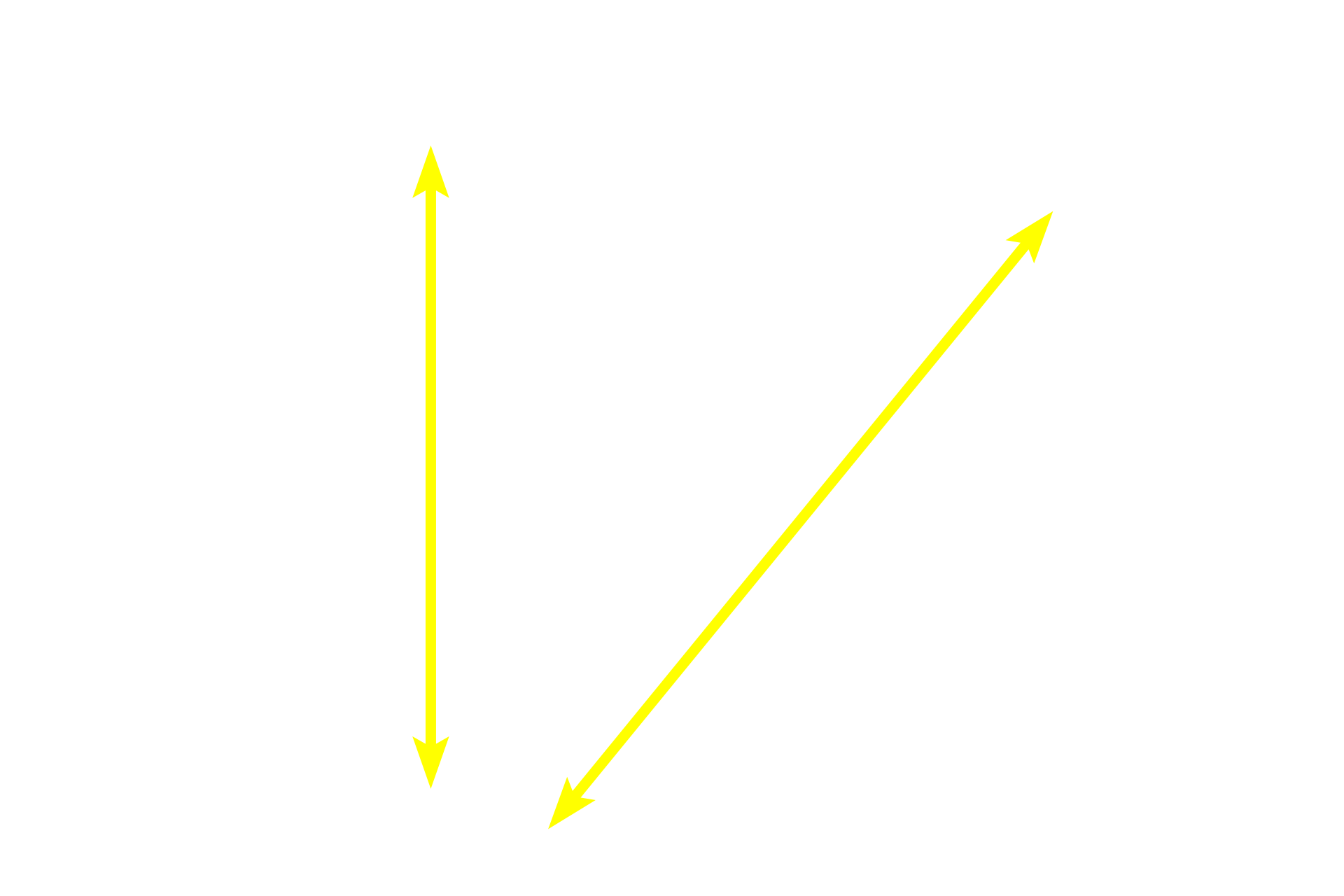 Epithelium <p>The small intestine is lined by a simple columnar epithelium, primarily composed of absorptive enterocytes with microvilli.  Scattered goblet cells with their expanded apical portions containing mucinogen are visible.  Also present are lymphocytes, macrophages and microfold or M cells.  M cells (not visible here) occur among the enterocytes, but lack microvilli; instead having microfolds of their apical surface membrane  that endocytose antigens, transporting them to surveilling lymphoid tissue in the lamina propria beneath them.  M cells are antigen delivery cells for initiating mucosal immune responses.  1000x  </p>
