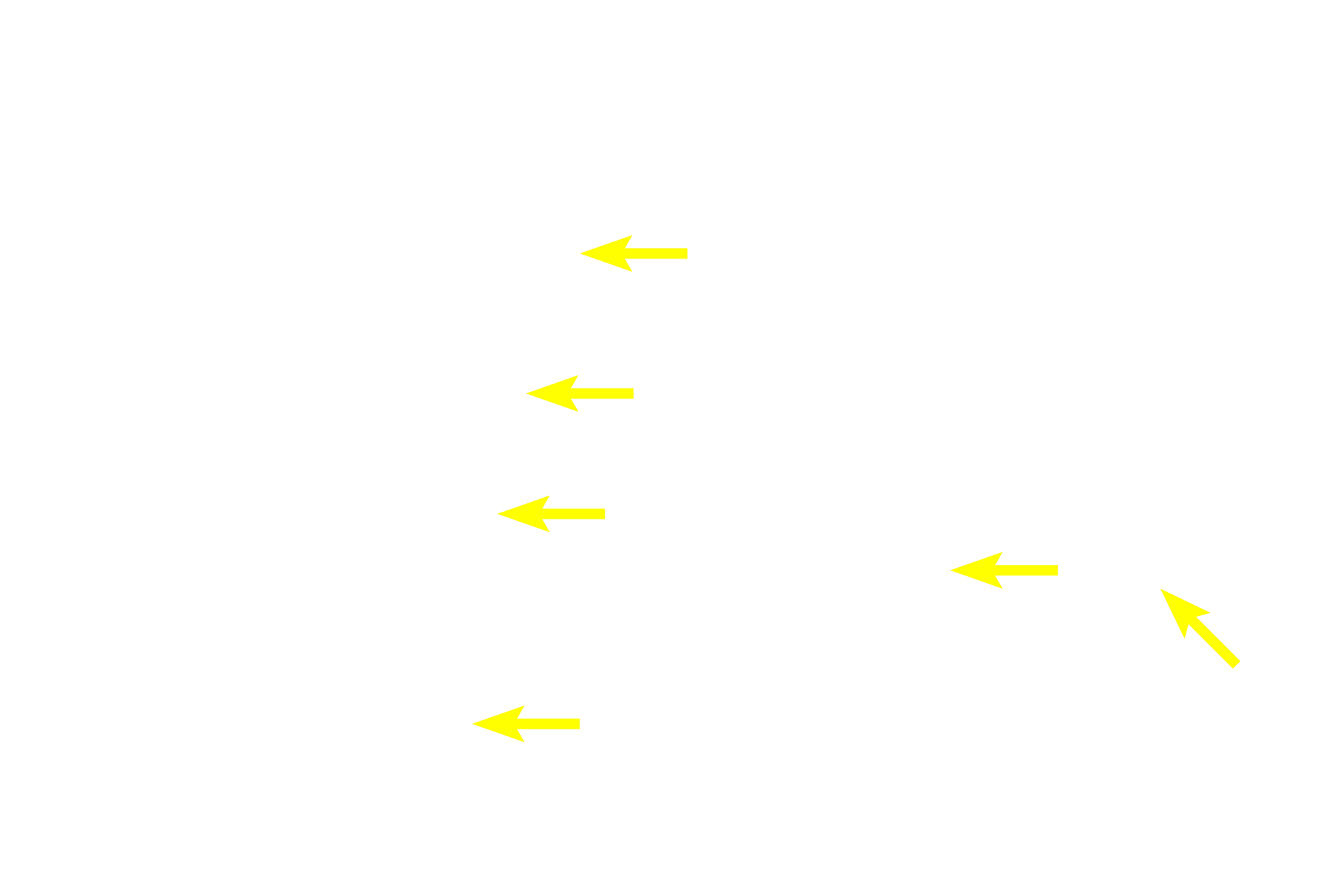  - Goblet cells <p>The small intestine is lined by a simple columnar epithelium, primarily composed of absorptive enterocytes with microvilli.  Scattered goblet cells with their expanded apical portions containing mucinogen are visible.  Also present are lymphocytes, macrophages and microfold or M cells.  M cells (not visible here) occur among the enterocytes, but lack microvilli; instead having microfolds of their apical surface membrane  that endocytose antigens, transporting them to surveilling lymphoid tissue in the lamina propria beneath them.  M cells are antigen delivery cells for initiating mucosal immune responses.  1000x  </p>
