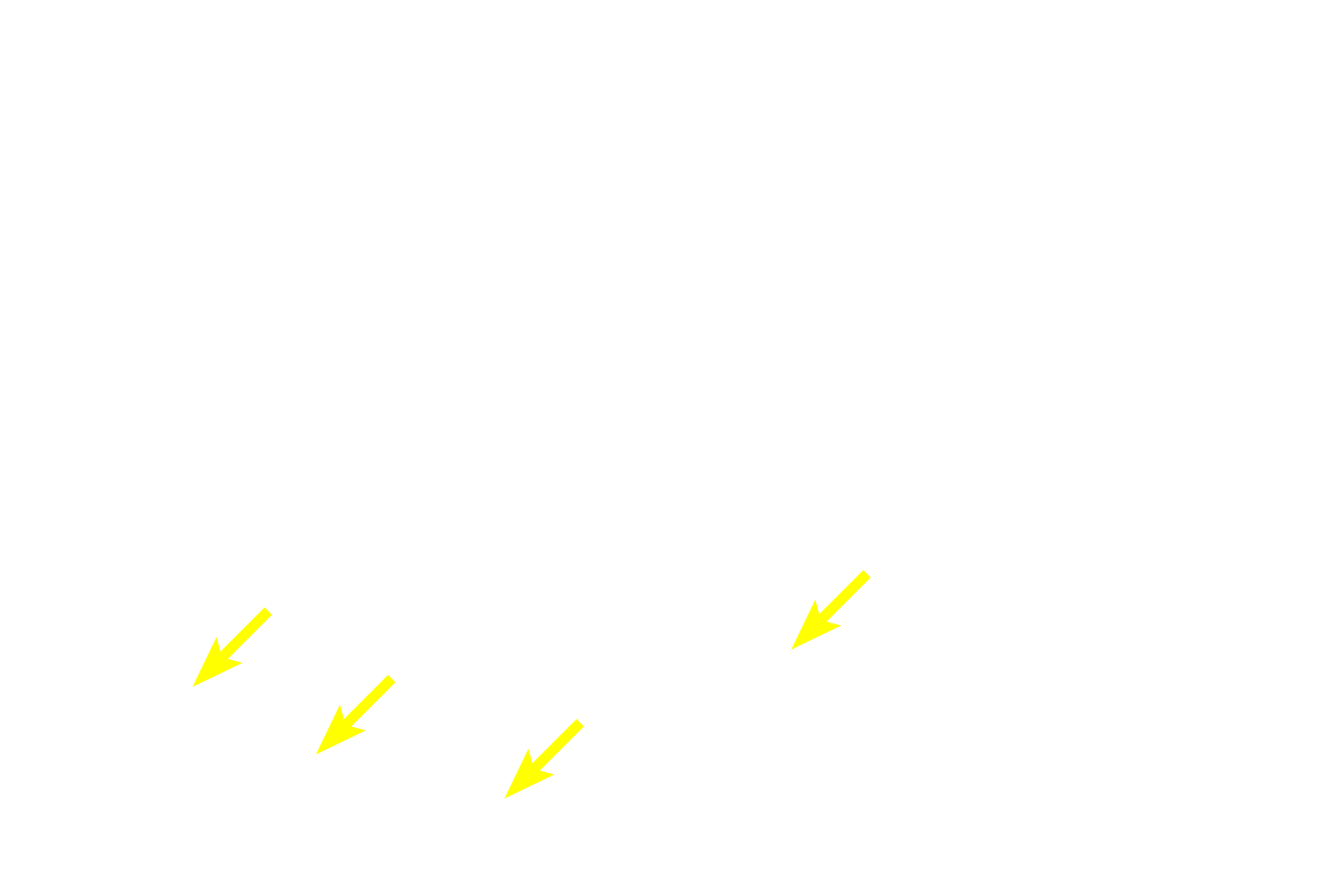 Lymphocytes and macrophages <p>The small intestine is lined by a simple columnar epithelium, primarily composed of absorptive enterocytes with microvilli.  Scattered goblet cells with their expanded apical portions containing mucinogen are visible.  Also present are lymphocytes, macrophages and microfold or M cells.  M cells (not visible here) occur among the enterocytes, but lack microvilli; instead having microfolds of their apical surface membrane  that endocytose antigens, transporting them to surveilling lymphoid tissue in the lamina propria beneath them.  M cells are antigen delivery cells for initiating mucosal immune responses.  1000x  </p>
