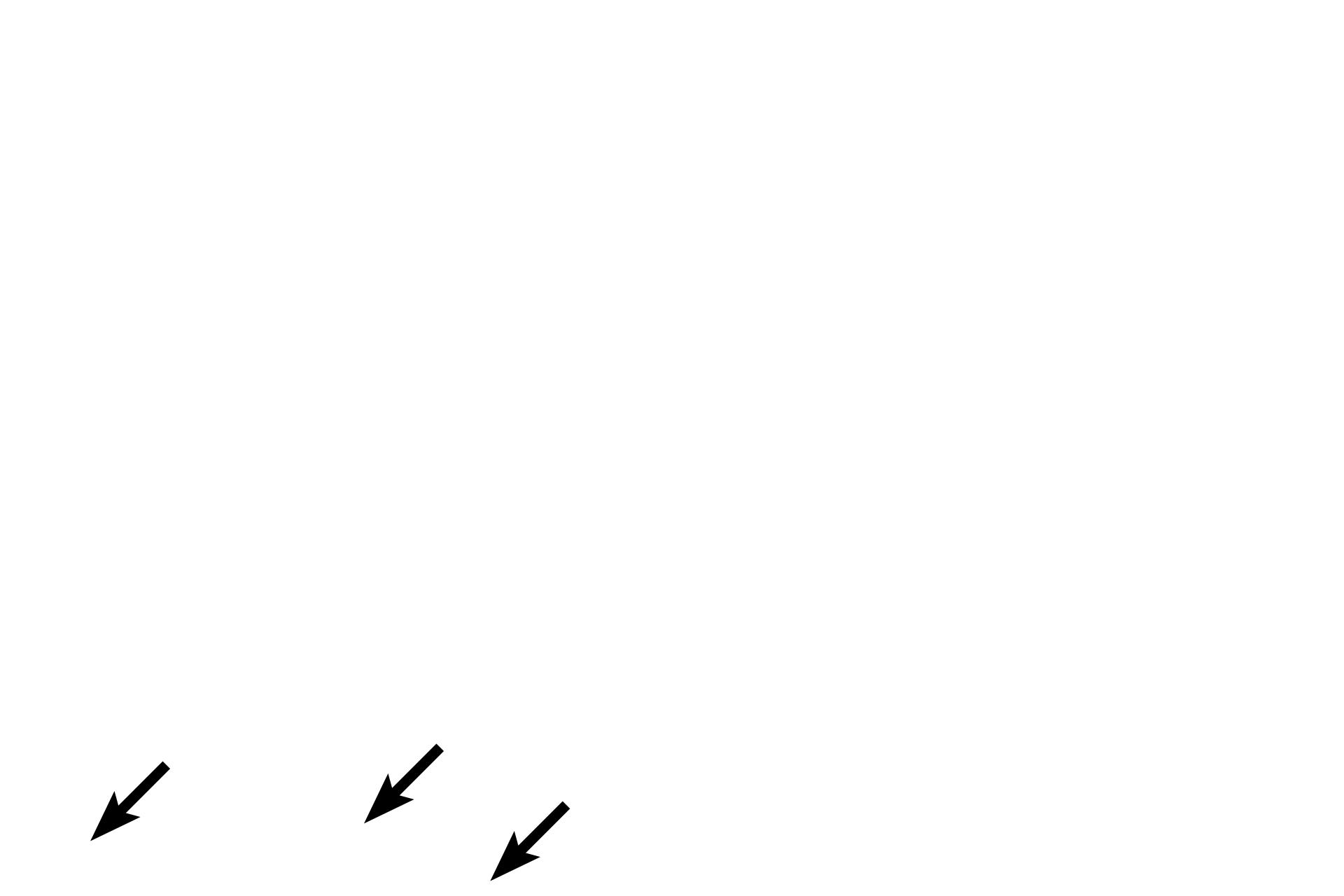 Lamina propria <p>The small intestine is lined by a simple columnar epithelium, primarily composed of absorptive enterocytes with microvilli.  Scattered goblet cells with their expanded apical portions containing mucinogen are visible.  Also present are lymphocytes, macrophages and microfold or M cells.  M cells (not visible here) occur among the enterocytes, but lack microvilli; instead having microfolds of their apical surface membrane  that endocytose antigens, transporting them to surveilling lymphoid tissue in the lamina propria beneath them.  M cells are antigen delivery cells for initiating mucosal immune responses.  1000x  </p>
