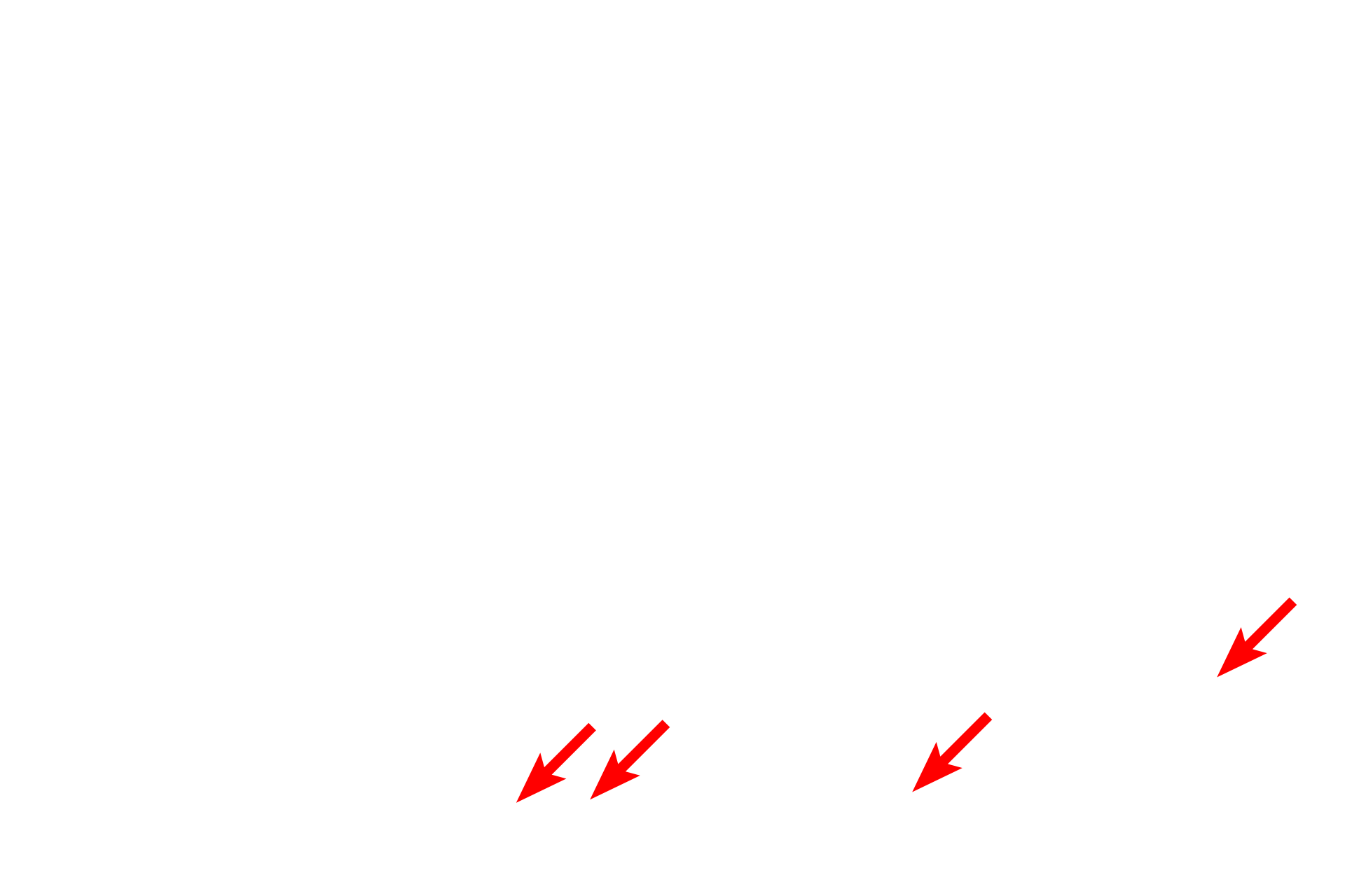  - Paneth cells <p>Epithelial invaginations into the lamina propria of the small intestine form the intestinal glands, also known as the glands or crypts of Lieberkuhn.  The bases of these glands extend down to the muscularis mucosae.  Intestinal glands contain goblet cells, absorptive cells, Paneth cells, enteroendocrine (DNES) cells and stem cells.  400x</p>
