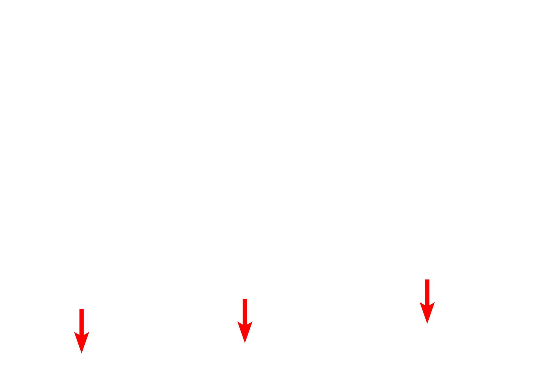  - Muscularis mucosae <p>Epithelial invaginations into the lamina propria of the small intestine form the intestinal glands, also known as the glands or crypts of Lieberkuhn.  The bases of these glands extend down to the muscularis mucosae.  Intestinal glands contain goblet cells, absorptive cells, Paneth cells, enteroendocrine (DNES) cells and stem cells.  400x</p>
