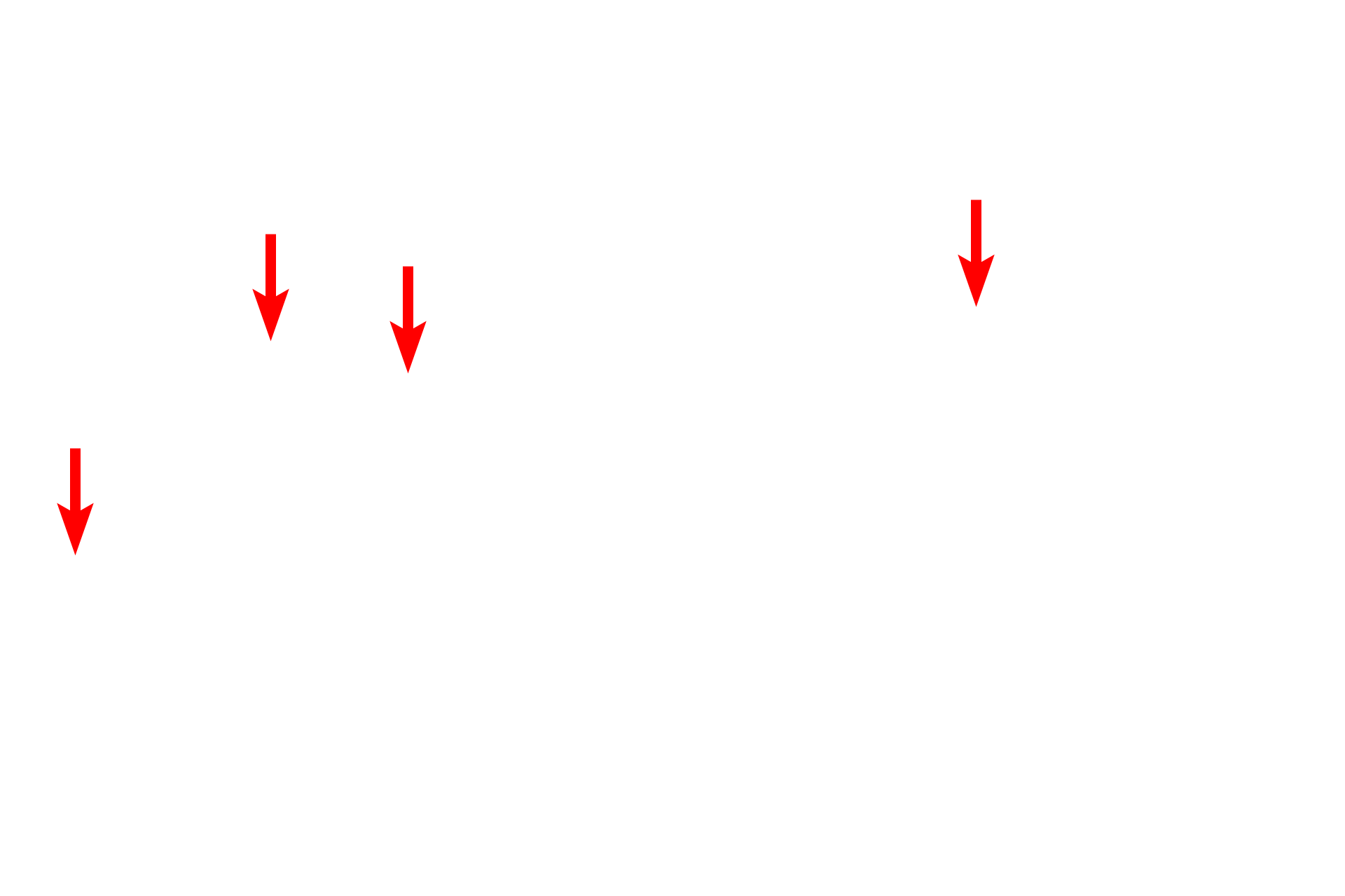 Absorptive cells <p>Lacteals, blind-ended lymphatic capillaries located in the lamina propria of villi, are present throughout the small intestine, but are more numerous in the jejunum and ileum.  Lacteals function in the absorption and transport dietary lipids by absorbing lipoprotein particles, called chylomicrons, produced by the enterocytes.  The lacteals in this image are abnormally distended.  300x</p>
