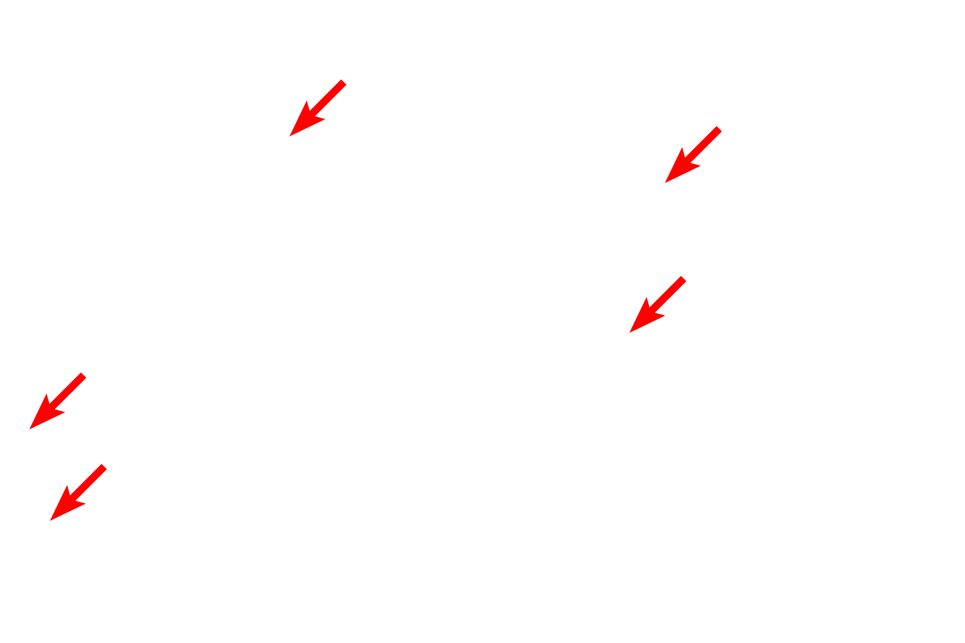 Goblet cells <p>Lacteals, blind-ended lymphatic capillaries located in the lamina propria of villi, are present throughout the small intestine, but are more numerous in the jejunum and ileum.  Lacteals function in the absorption and transport dietary lipids by absorbing lipoprotein particles, called chylomicrons, produced by the enterocytes.  The lacteals in this image are abnormally distended.  300x</p>
