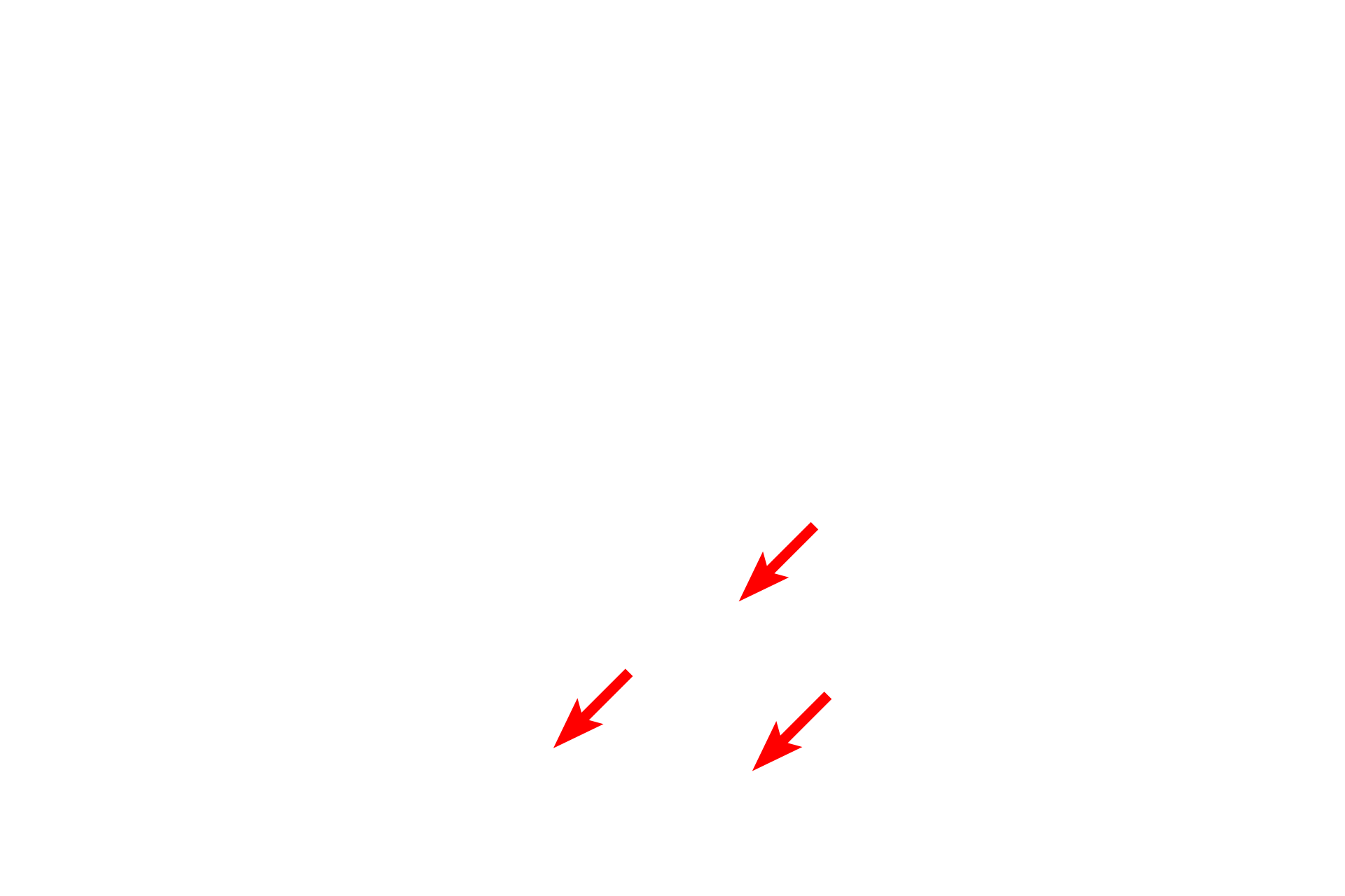 Intestinal glands <p>Lacteals, blind-ended lymphatic capillaries located in the lamina propria of villi, are present throughout the small intestine, but are more numerous in the jejunum and ileum.  Lacteals function in the absorption and transport dietary lipids by absorbing lipoprotein particles, called chylomicrons, produced by the enterocytes.  The lacteals in this image are abnormally distended.  300x</p>
