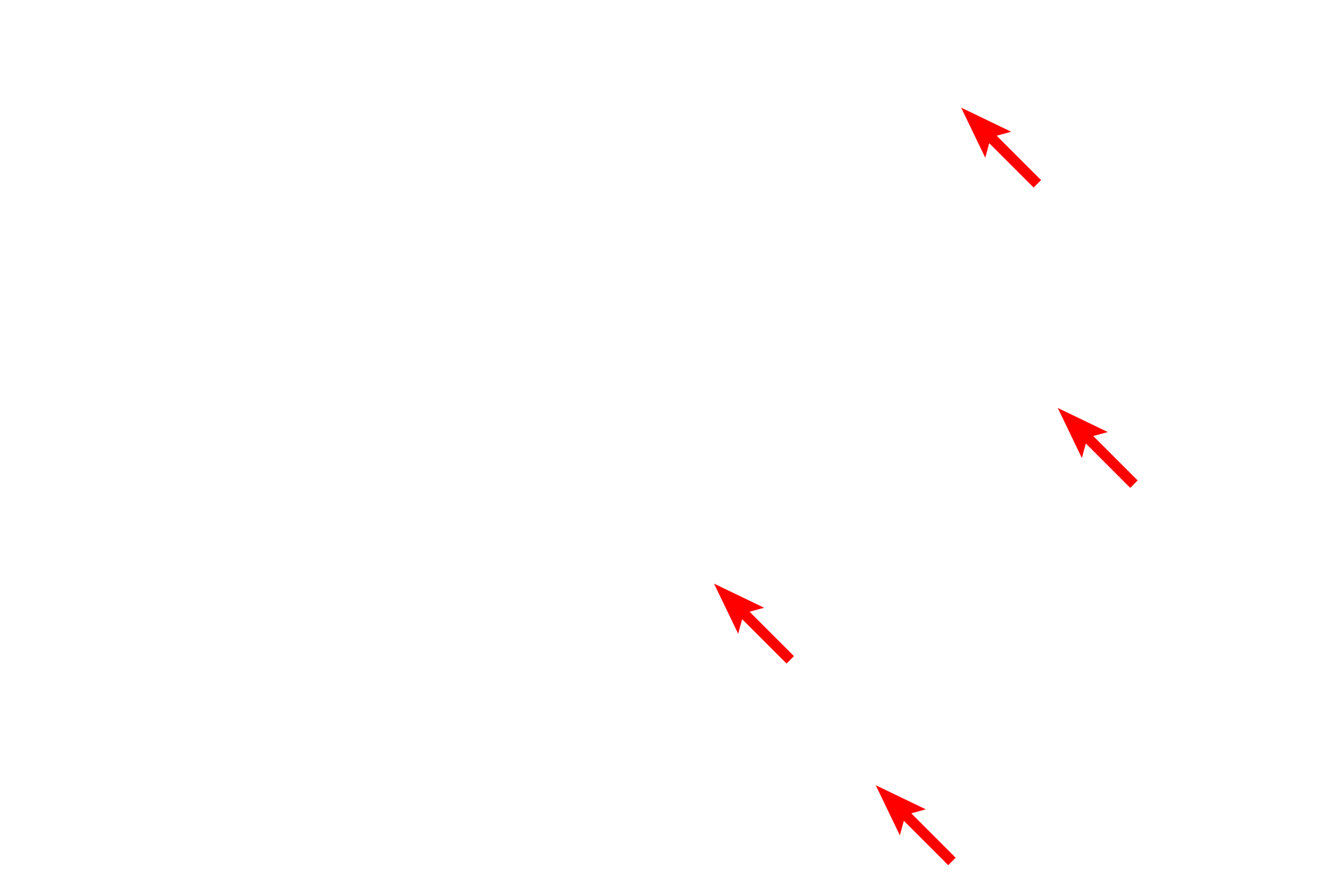 Reticular fibers <p>The cells in lymphoid nodules, lymph nodes, spleen and bone marrow are supported by a connective tissue stroma composed of reticular connective tissue.  Reticular connective tissue consists of reticular fibers composed of Type III collagen and the reticular cells that produce them.  Reticular fibers branch, forming a meshwork that supports macrophages and lymphocytes while allowing fluid to readily percolate through the tissue for optimal monitoring by the immune cells.  Reticular fibers are not visible with H & E (left images), they require special stains like the silver stain shown here (right). Lymph node, 400x (l); 800x (r and inset) </p>
