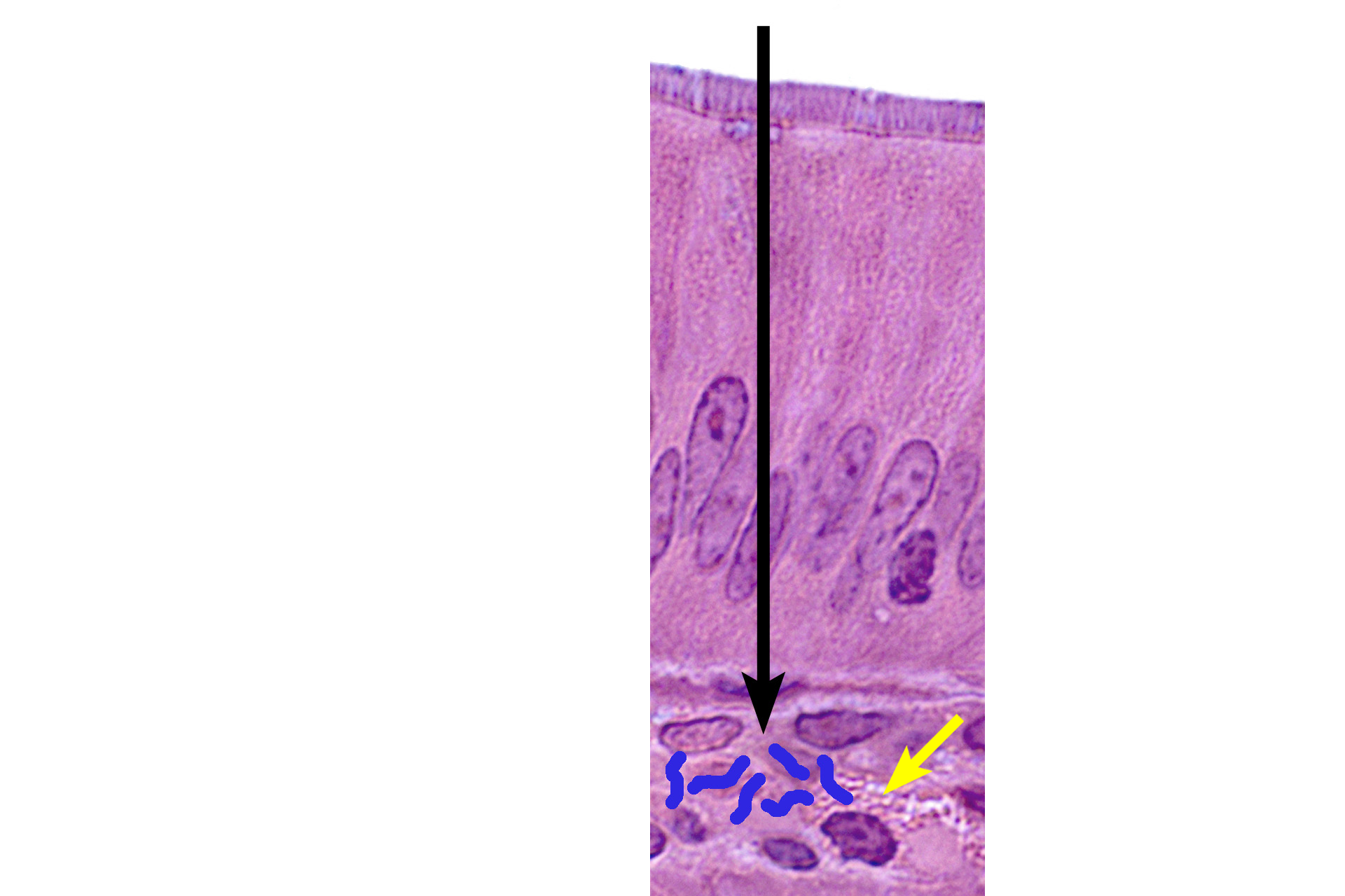  - Mast cell >  <p>Mast cells contain cytoplasmic granules that are released in response to contact with microbes or antigens, eliciting an allergic reaction.</p>
