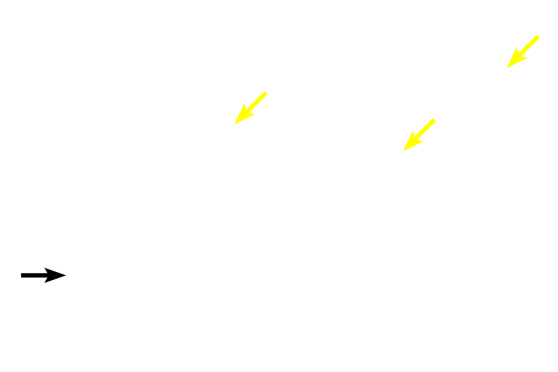  - Bone marrow tissue > <p>Red bone marrow consists of multipotential stem cells and their progeny that form mature blood cells and platelets.  Newly formed blood cells enter the circulatory system by traversing thin-walled sinusoids (discontinuous capillaries) in the marrow.  Red marrow also contains adipocytes that, with age, increase in number eventually constituting the major cell type forming inactive, yellow marrow.    </p>
