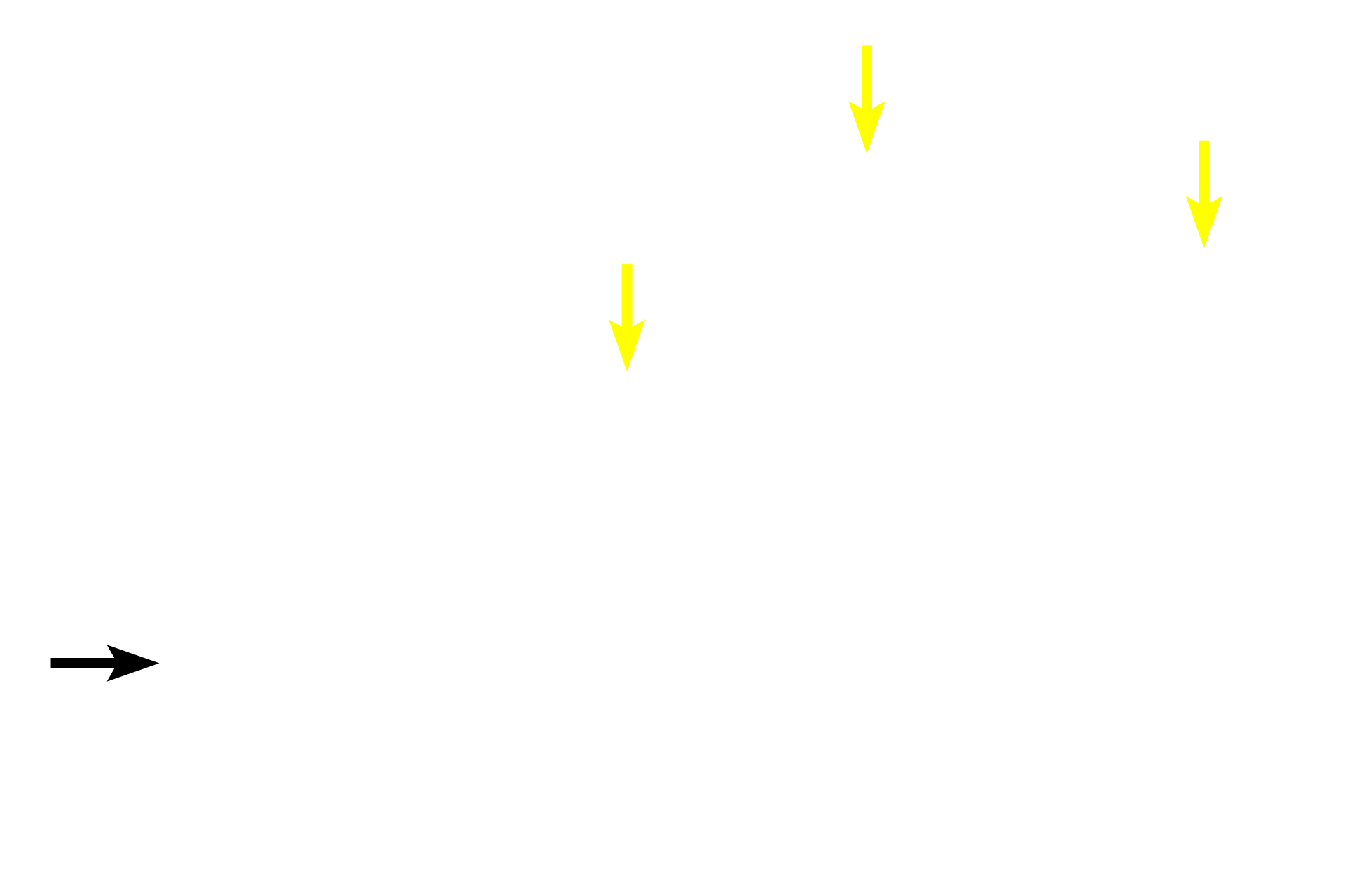  - Sinusoids <p>Red bone marrow consists of multipotential stem cells and their progeny that form mature blood cells and platelets.  Newly formed blood cells enter the circulatory system by traversing thin-walled sinusoids (discontinuous capillaries) in the marrow.  Red marrow also contains adipocytes that, with age, increase in number eventually constituting the major cell type forming inactive, yellow marrow.    </p>
