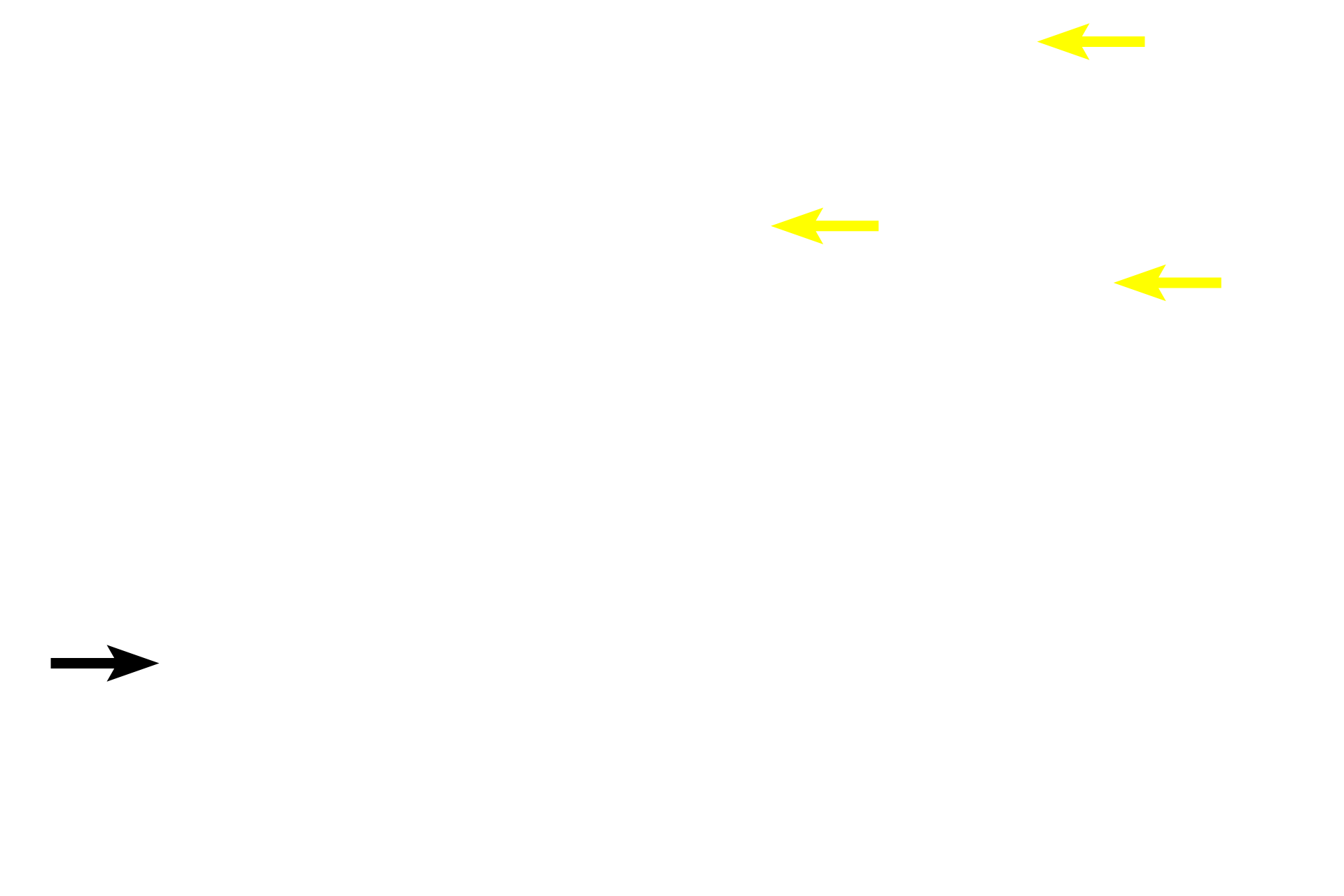  - Adipocytes <p>Red bone marrow consists of multipotential stem cells and their progeny that form mature blood cells and platelets.  Newly formed blood cells enter the circulatory system by traversing thin-walled sinusoids (discontinuous capillaries) in the marrow.  Red marrow also contains adipocytes that, with age, increase in number eventually constituting the major cell type forming inactive, yellow marrow.    </p>
