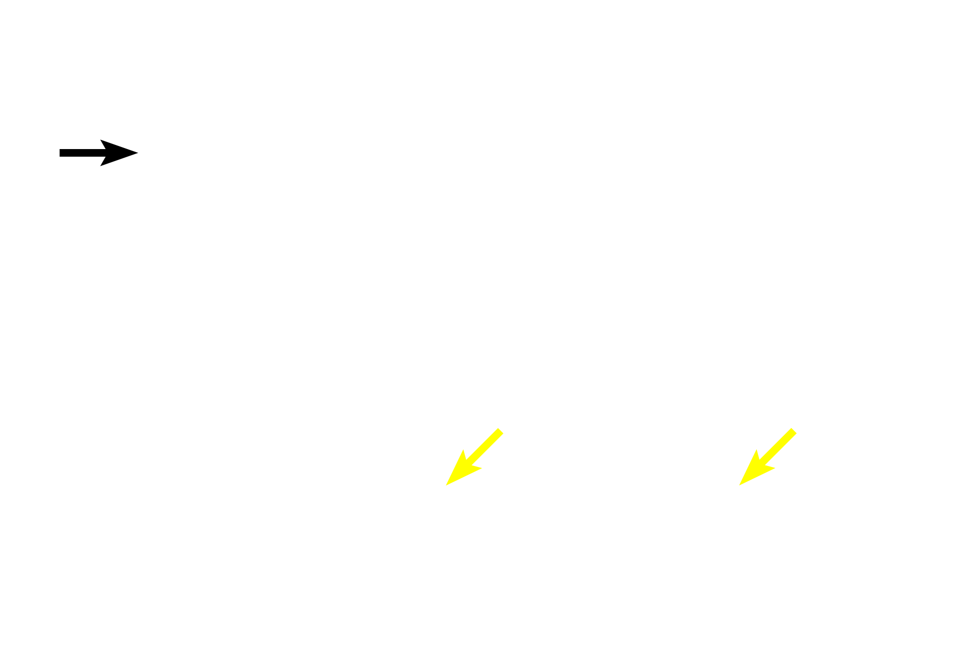  - Medulla <p>The thymus is a highly lobulated organ that consists of a cortex and medulla.  Cortex, intensely basophilic due to the large number of T cells present, is the site of T cell maturation and selection.  Migration of mature T cells from the thymus occurs in the medulla, which is less intensely stained.</p>

