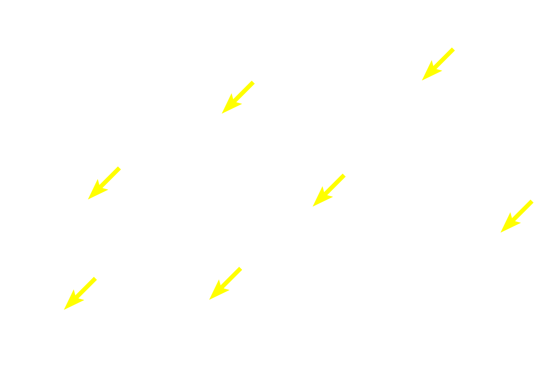 Diffuse lymphoid tissue  <p>Diffuse lymphoid tissue consists of scattered immune cells (lymphocytes and macrophages) that monitor the tissue fluid around them for the presence of foreign antigens.  Antigen detection initiates an adaptive immune response as well as recruitment of additional B and T lymphocytes, leading to the formation of lymphoid nodules, discrete clusters of lymphocytes in the lamina propria.</p>
